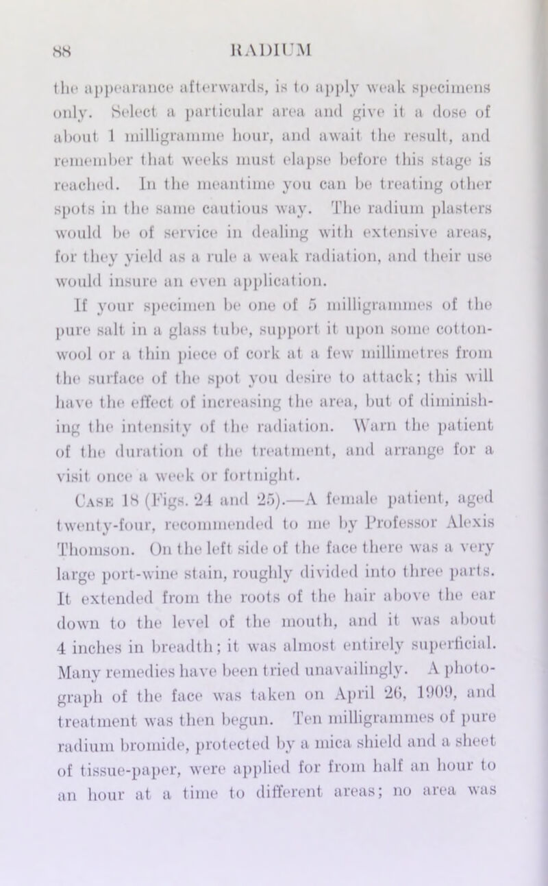 tin* appearance afterwards, is to apply weak specimens only. Select a particular area and give it a dose of about 1 milligramme hour, and await the result, and remember that weeks must elapse before this stage is reached. In the meantime you can be treating other spots in the same cautious way. The radium plasters would be of service in dealing with extensive areas, for they yield as a rule a weak radiation, and their use would insure an even application. If your specimen be one of 5 milligrammes of the pure salt in a glass tube, support it upon some cotton- wool or a thin piece of cork at a few millimetres from the surface of the spot you desire to attack; this will have the effect of increasing the area, but of diminish- ing the intensity of tbe radiation. Warn the patient of the duration of the treatment, and arrange for a visit once a week or fortnight. Case 18 (Figs. 24 and 25).—A female patient, aged twenty-four, recommended to me by Professor Alexis Thomson. On the left side of the face there was a very large port-wine stain, roughly divided into three parts. It extended from the roots of the hair above the ear down to the level of the mouth, and it was about 4 inches in breadth; it was almost entirely superficial. Many remedies have been tried unavailingly. A photo- graph of the face was taken on April *2(5, 1909, and treatment was then begun. Ten milligrammes of pure radium bromide, protected by a mica shield and a sheet of tissue-paper, were applied for from half an hour to an hour at a time to different areas; no area was