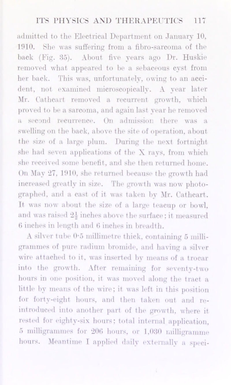 admitted to the Electrical Department on January 10, 1010. She was suffering from a fibro-sarcoma of the hack (Fig. 85). About five years ago Dr. Huskie removed what appeared to be a sebaceous cyst from her back. This was, unfortunately, owing to an acci- dent, not examined microscopically. A year later Mr. Cathcart removed a recurrent growth, which proved to be a sarcoma, and again last year he removed a second recurrence. On admission there was a swelling on the back, above the site of operation, about the size of a large plum. During the next fortnight she had seven applications of the X rays, from which she received some benefit, and she then returned home. On May 27, 1910, she returned because the growth had increased greatly in size. The growth was now photo- graphed, and a cast of it was taken by Mr. Cathcart. It was now about the size of a large teacup or bowl, and was raised 2.1 inches above the surface; it measured 0 inches in length and 0 inches in breadth. A silver tube 0*5 millimetre thick, containing 5 milli- grammes of pure radium bromide, and having a silver wire attached to it. was inserted bv means of a trocar into the growth. After remaining for seventy-two hours in one position, it was moved along the tract a little by means of the wire; it was left in this position for forty-eight hours, and then taken out and re- introduced into another part of the growth, where it rested for eightv-six hours; total internal application, 5 milligrammes for 200 hours, or 1,080 milligramme hours. Meantime T applied daily externally a speci-