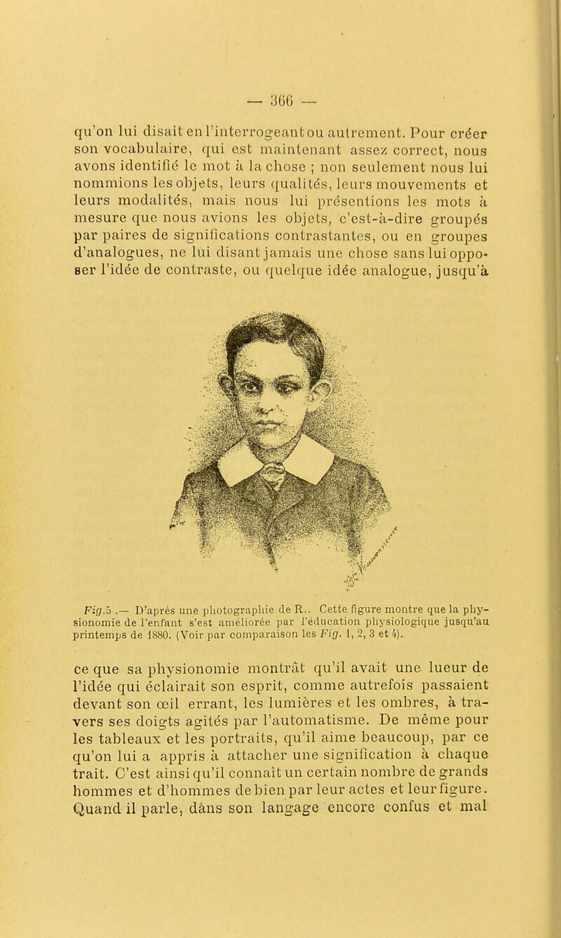 qu'on lui disait enriiiterrogeantou autrement. Pour créer son vocabulaire, qui est maintenant assez correct, nous avons identifié le mot à la chose ; non seulement nous lui nommions les objets, leurs ({ualités, leurs mouvements et leurs modalités, mais nous lui présentions les mots à mesure que nous avions les objets, c'est-à-dire groupés par paires de significations contrastantes, ou en groupes d'analogues, ne lui disant jamais une chose sans lui oppo- ser l'idée de contraste, ou quelque idée analogue, jusqu'à Fig.h .— D'après une pliotograpliie de R.. Cette figure montre que la phy- sionomie de l'enfant s'est améliorée par l'éducation physiologique jusqu'au printemps de 1880. (Voir par comparaison les Fig. 1, 2, 3 et 4). ce que sa physionomie montrât qu'il avait une lueur de l'idée qui éclairait son esprit, comme autrefois passaient devant son œil errant, les lumières et les ombres, à tra- vers ses doigts agités par l'automatisme. De même pour les tableaux et les portraits, qu'il aime beaucoup, par ce qu'on lui a appris à attacher une signification à chaque trait. C'est ainsi qu'il connaît un certain nombre de grands hommes et d'hommes de bien par leur actes et leur figure. Quand il parle, dans son langage encore confus et mal
