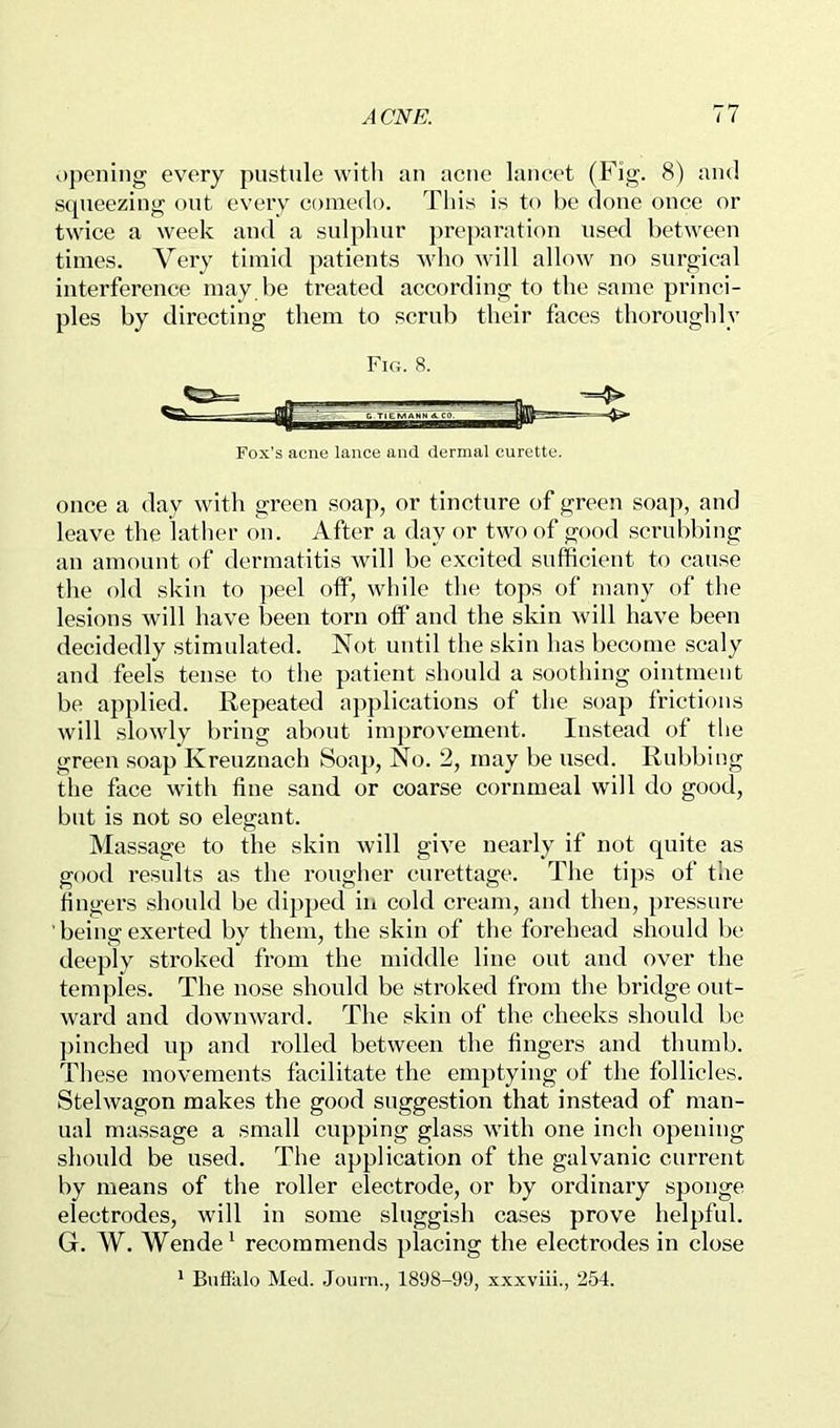 opening every pustule with an acne lancet (Fig. 8) and squeezing out every comedo. This is to he done once or twice a week and a sulphur preparation used between times. Very timid patients who will allow no surgical interference may be treated according to the same princi- ples by directing them to scrub their faces thoroughly Fox’s acne lance and dermal curette. once a day with green soap, or tincture of green soap, and leave the lather on. After a day or two of good scrubbing an amount of dermatitis will be excited sufficient to cause the old skin to peel off, while the tops of many of tlie lesions will have been torn off and the skin will have been decidedly stimulated. Not until the skin has become scaly and feels tense to the patient should a soothing ointment be applied. Repeated applications of the soap frictions will slowly bring about improvement. Instead of tlie green soap Kreuznach Soaj), No. 2, may be used. Rubbing the face with fine sand or coarse cornmeal will do good, but is not so elegant. Massage to the skin will give nearly if not quite as good results as the rougher curettage. The tips of the fingers should be dipped in cold cream, and then, pressure being exerted by them, the skin of the forehead should be deeply stroked from the middle line out and over the temples. The nose should be stn>ked from the bridge out- ward and downward. The skin of the cheeks should be ])inched up and rolled between the fingers and thumb. These movements facilitate the emptying of the follicles. Stelwagon makes the good suggestion that instead of man- ual massage a small cupping glass with one inch opening should be used. The application of the galvanic current by means of the roller electrode, or by ordinary sponge electrodes, will in some sluggish cases prove helpful. G. W. Wende^ recommends placing the electrodes in close * Bnflixlo Med. Journ., 1898-99, xxxviii., 254.