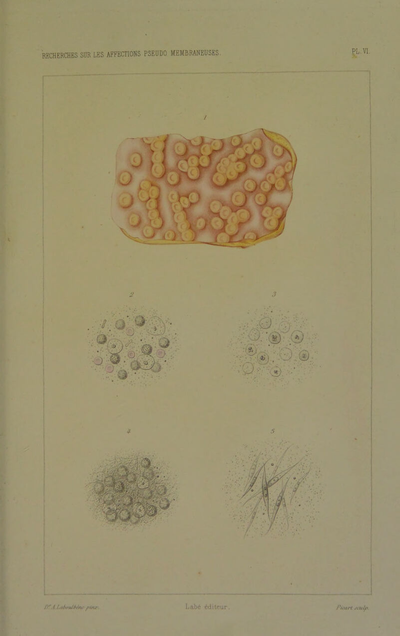 PL, VI, i-Liihoulhriu- /'iftr. LaLio cditr-ur-