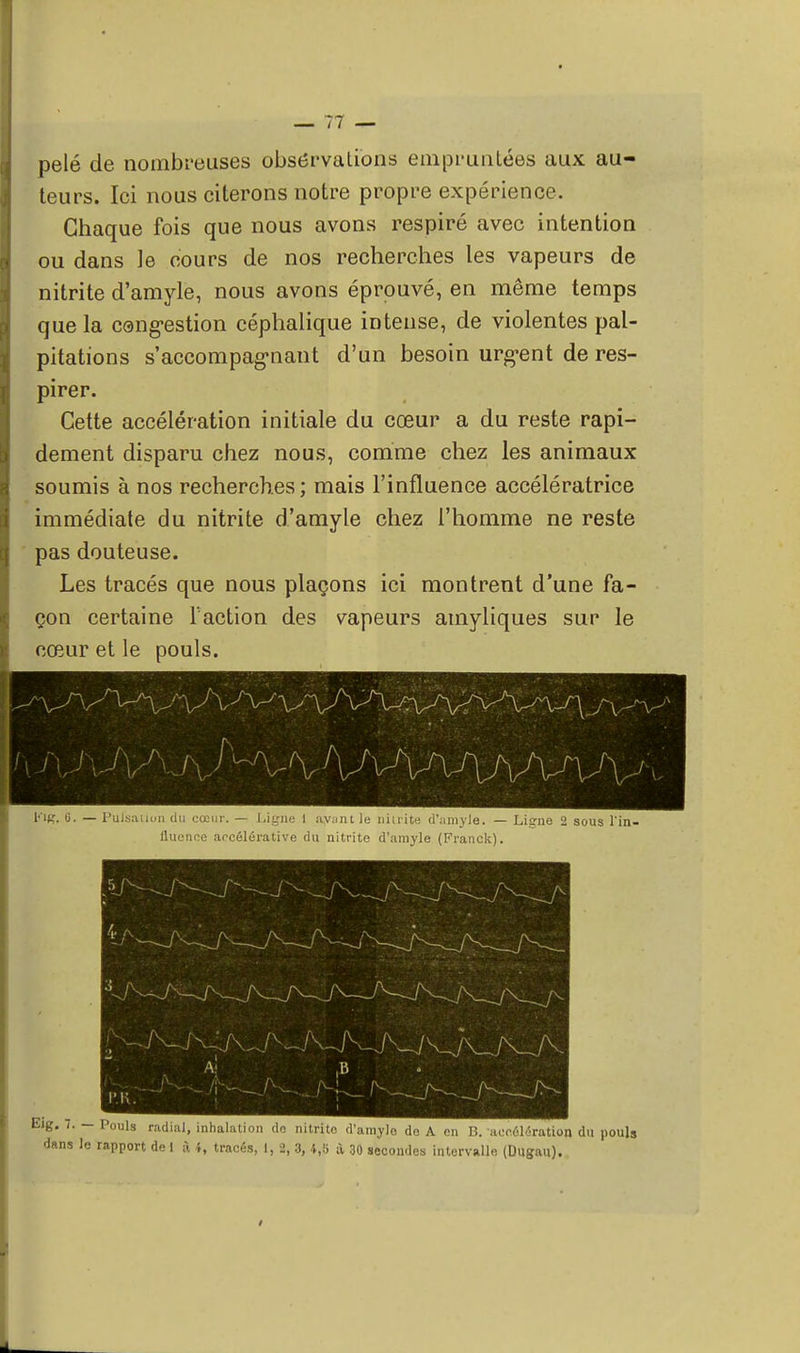pelé de nombreuses observations empruntées aux au- teurs. Ici nous citerons notre propre expérience. Chaque fois que nous avons respiré avec intention ou dans le cours de nos recherches les vapeurs de nitrite d'amyle, nous avons éprouvé, en même temps que la congestion céphalique intense, de violentes pal- pitations s'accompagnant d'un besoin urgent de res- pirer. Cette accélération initiale du cœur a du reste rapi- dement disparu chez nous, comme chez les animaux soumis à nos recherches; mais l'influence accélératrice immédiate du nitrite d'amyle chez l'homme ne reste pas douteuse. Les tracés que nous plaçons ici montrent d'une fa- çon certaine l'action des vapeurs amyliques sur le cœur et le pouls. Kig. G. — Pulsation du cœur. — Ligné 1 ayant le nitrite d'amyle. — Ligne 2 sous l'in- fluence accélérative du nitrite d'amyle (Franck). Eig. 7. — Pouls radial, inhalation de nitrite d'amyle do A en B. accélération du pouls dans le rapport de 1 à i, tracés, I, 2, 3, X 30 secondes intervalle (Dugau). /
