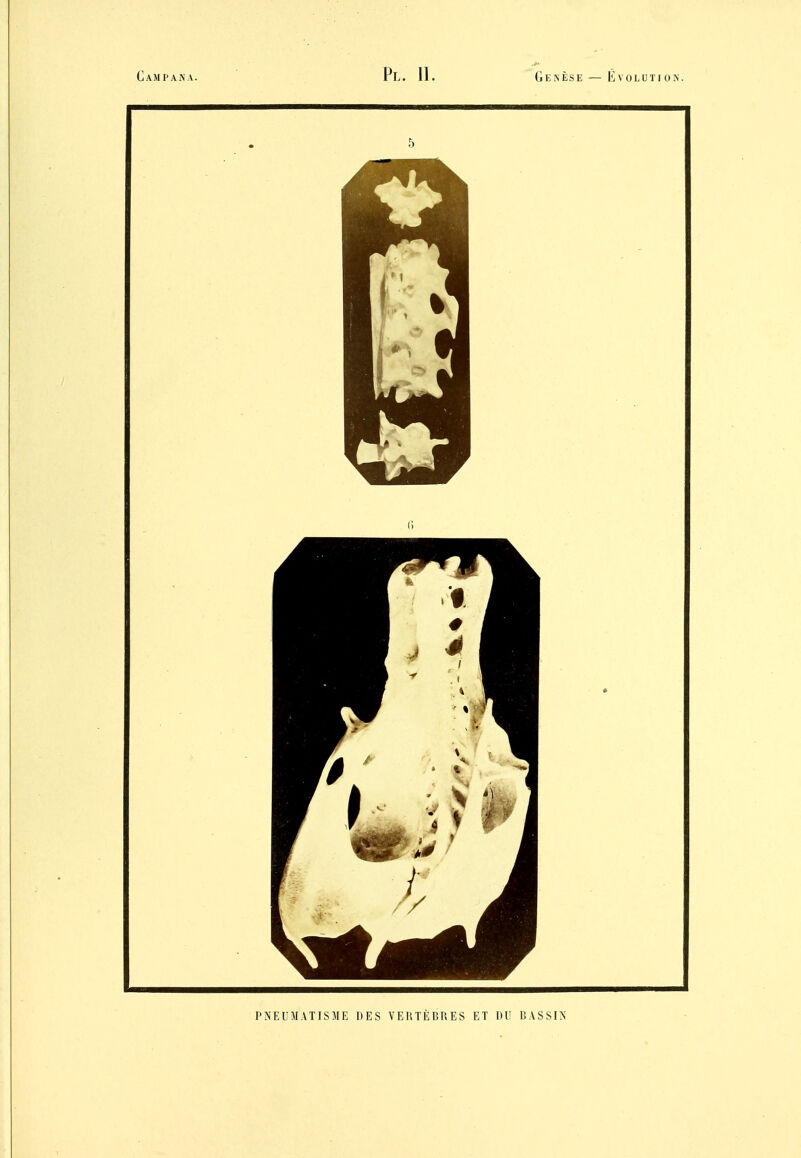 PNEUMATISME DES VEIiTÈDUES ET DU BASSIN