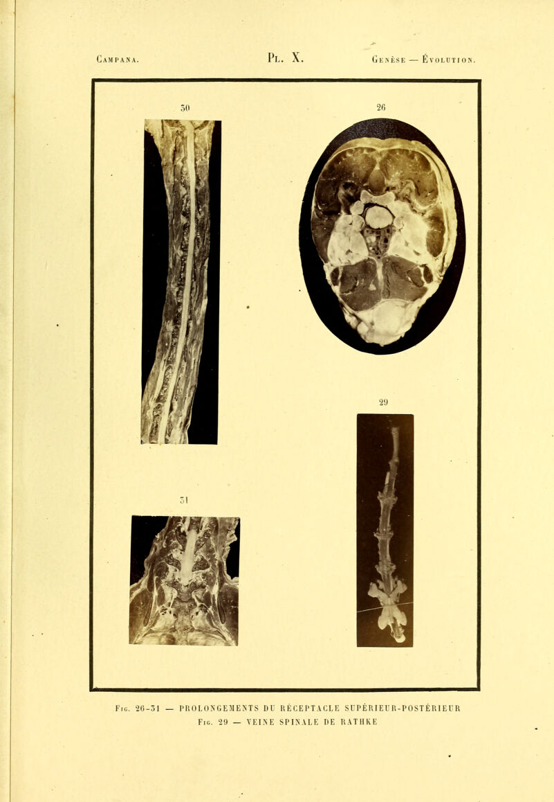 FiG. 2G-51 — l'UOLONGEMENTS DU RÉCEPTACLE SUPÉRIEUR-POSTÉRIEUR FiG. 29 — VEINE SPINALE DE RATURE