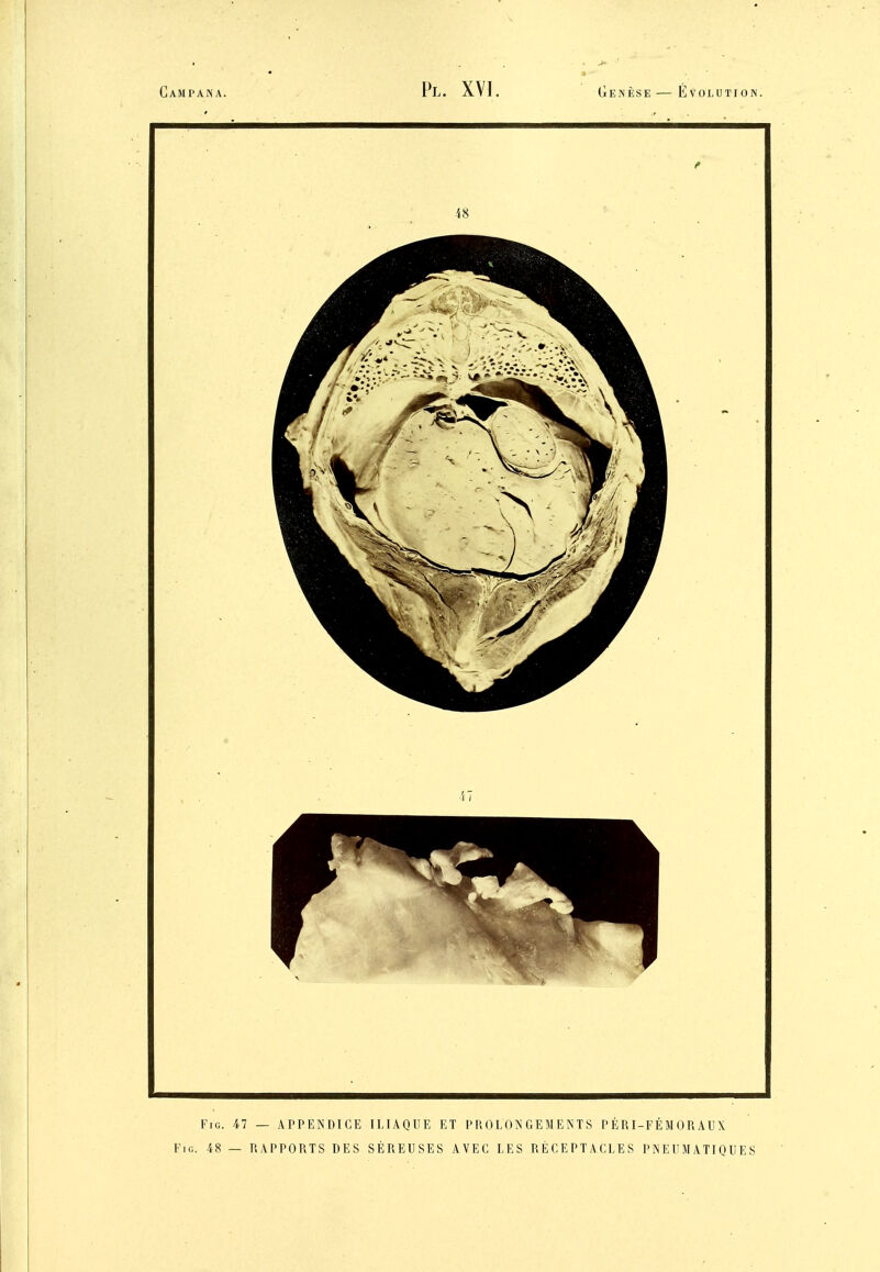 FiG. 47 — APPENDICE ILIAQUE ET PROLONGEMENTS PÉRI-FÉMORAUX FiG. 48 — RAPPORTS DES SÉREUSES AVEC LES RÉCEPTACLES PNEUMATIQUES