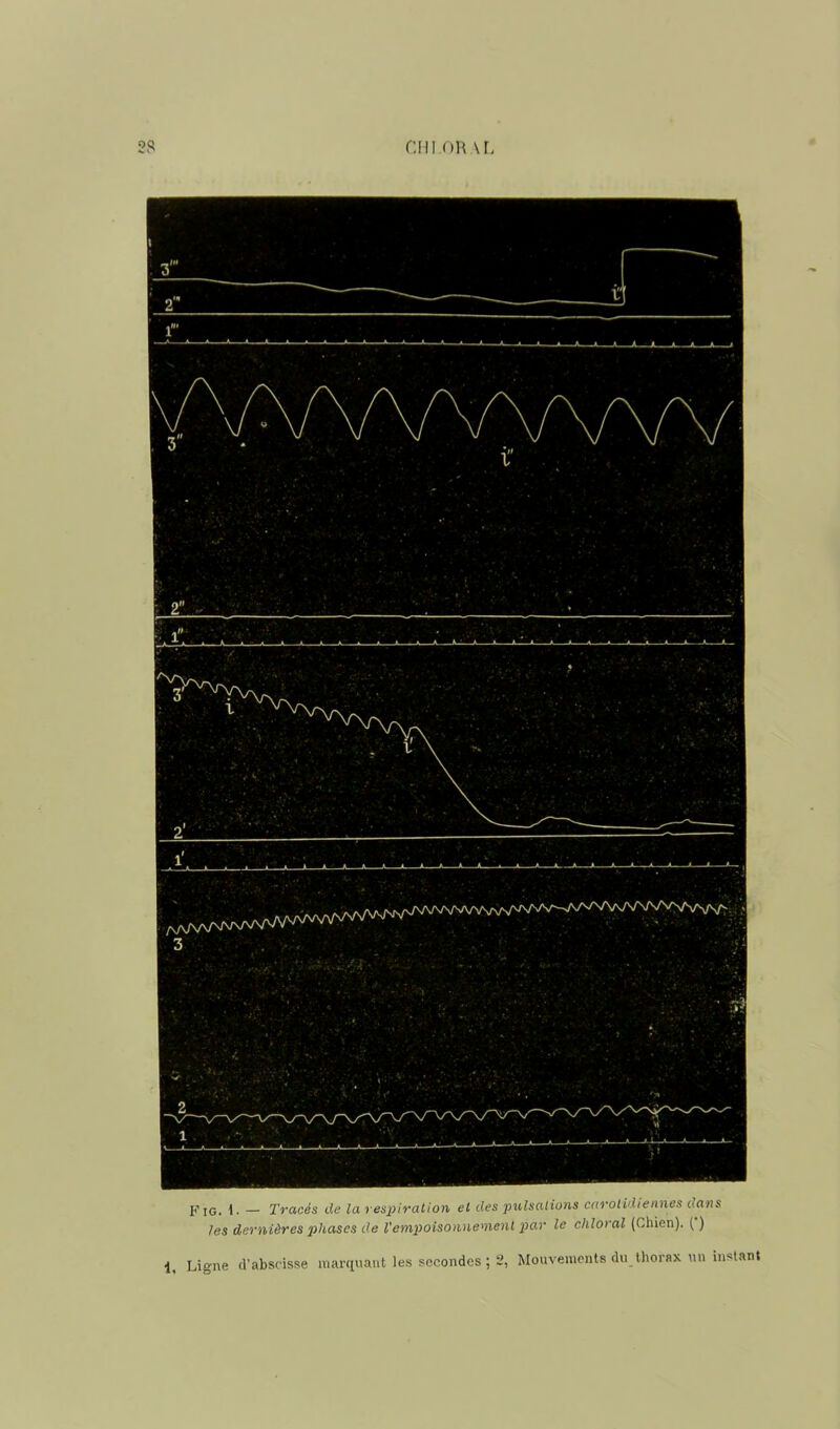 p [g, 1. — Tracés de la respiration et des pulsations carotidiennes dans les dernières phases de Vempoisonnement par le chloral (Chien). ( ) 1, Ligne d’abscisse marquant les secondes ; 2, Mouvements du thorax un instant