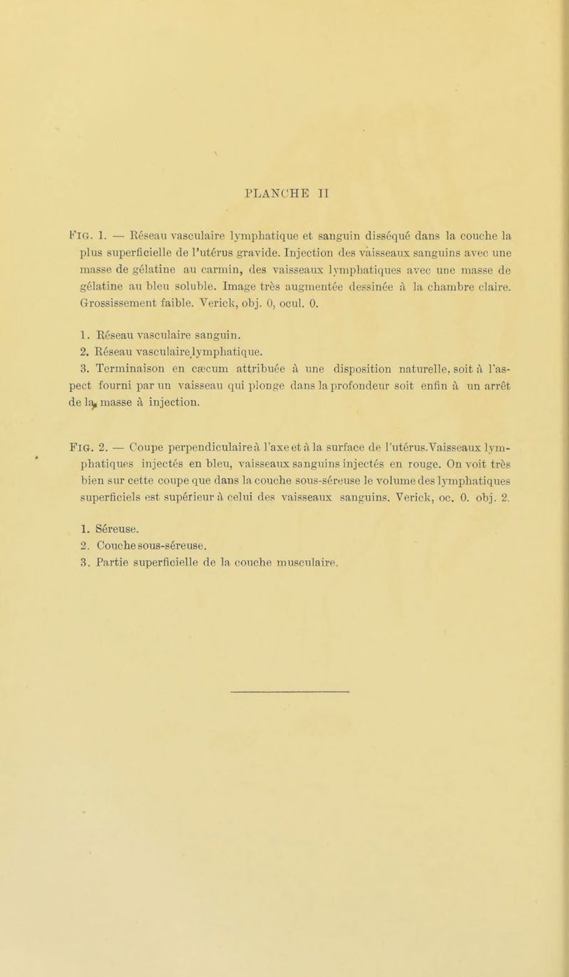 FiG. 1. — Réseau vasculaire lymphatique et sanguin disséqué dans la couche la plus superficielle de l'utérus gravide. Injection des vaisseaux sanguins aA^ec une masse de gélatine au carmin, des vaisseaux lymphatiques avec une masse de gélatine au bleu soluble. Image très augmentée dessinée à la chambre claire. Grossissement faible. Verick, obj. 0, ocul. 0. 1. Réseau vasculaire sanguin. 2. Réseau vasculairelymphatique. 3. Terminaison en ca3cum attribuée à une disposition naturelle, soit il l'as- pect fourni par un vaisseau qui plonge dans la profondeur soit enfin à un arrêt de 1^ masse :\ injection. FiG. 2. — Coupe perpendiculaireî\ l'axeetàla surface de l'utérus.Vaisseaux lym- phatiques injectés en bleu, vaisseaux sanguins injectés en rouge. On voit très bien sur cette coupe que dans la couche sous-séreuse le volume des lymphatiques superficiels est supérieur à celui des vaisseaux sanguins. Verick, oc. 0. obj. 2. 1. Séreuse. 2. Couche sous-séreuse. 3. Partie superficielle de la couche musculaire.