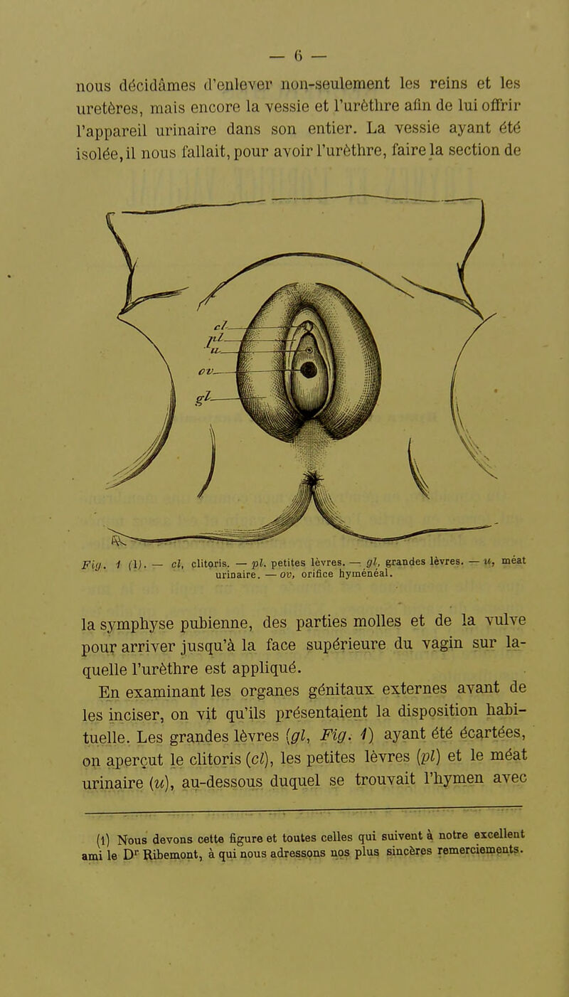 nous décidâmes d'enlever non-seulement les reins et les uretères, mais encore la vessie et l'urèthre afin de lui offrir l'appareil urinaire dans son entier. La vessie ayant été isolée, il nous fallait, pour avoir l'urèthre, faire la section de piij, i (l). — cl, clitoris. — pl. petites lèvres. — gl, grandes lèvres. — u, méat urinaire. —ou, orifice hyménéal. la symphyse pubienne, des parties molles et de la vulve pour arriver jusqu'à la face supérieure du vagin sur la- quelle l'urèthre est appliqué. En examinant les organes génitaux externes avant de les inciser, on vit qu'ils présentaient la disposition hahi- tuelle. Les grandes lèvres [gl, Fig. 1) ayant été écartées, on aperçut le clitoris {cl), les petites lèvres [vl) et le méat urinaire (w), au-dessous duquel se trouvait l'hymen avec (l) Nous devons cette figure et toutes celles qui suivent à notre excellent ù le D Ribemont, à qui nous adrea§.ons nos plus sincères remerciements.