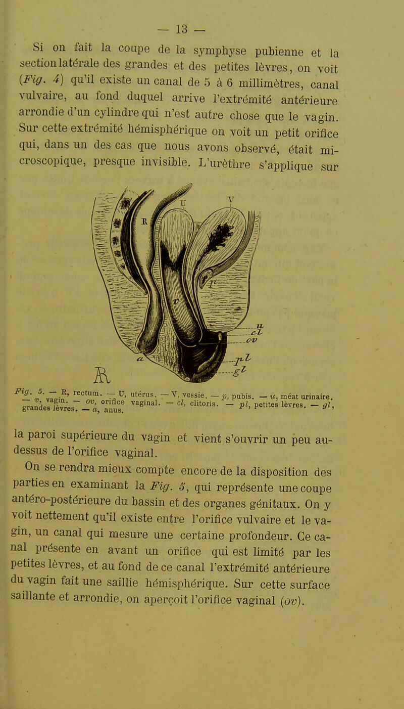 Si on fait la coupe de la symphyse pubienne et la section latérale des grandes et des petites lèvres, on voit {Fig. 4) qu'il existe un canal de 5 à 6 millimètres, canal vulvaire, au fond duquel arrive l'extrémité antérieure arrondie d'un cylindre qui n'est autre chose que le vagin. Sur cette extrémité hémisphérique on voit un petit orifice qui, dans un des cas que nous avons observé, était mi- croscopique, presque invisible. L'urèthre s'applique sur ^- v'yTirin' ^' ~  Pu^s. - M, méat urinaire. la paroi supérieure du vagin et vient s'ouvrir un peu au- dessus de l'orifice vaginal. On se rendra mieux compte encore de la disposition des parties en examinant la Fig. S, qui représente une coupe antéro-postérieure du bassin et des organes génitaux. On y voit nettement qu'il existe entre l'orifice vulvaire et le va- gm, un canal qui mesure une certaine profondeur. Ce ca- nal présente en avant un orifice qui est hmité par les petites lèvres, et au fond de ce canal l'extrémité antérieure du vagin fait une saillie hémisphérique. Sur cette surface saillante et arrondie, on aperçoit l'orifice vaginal {ov).