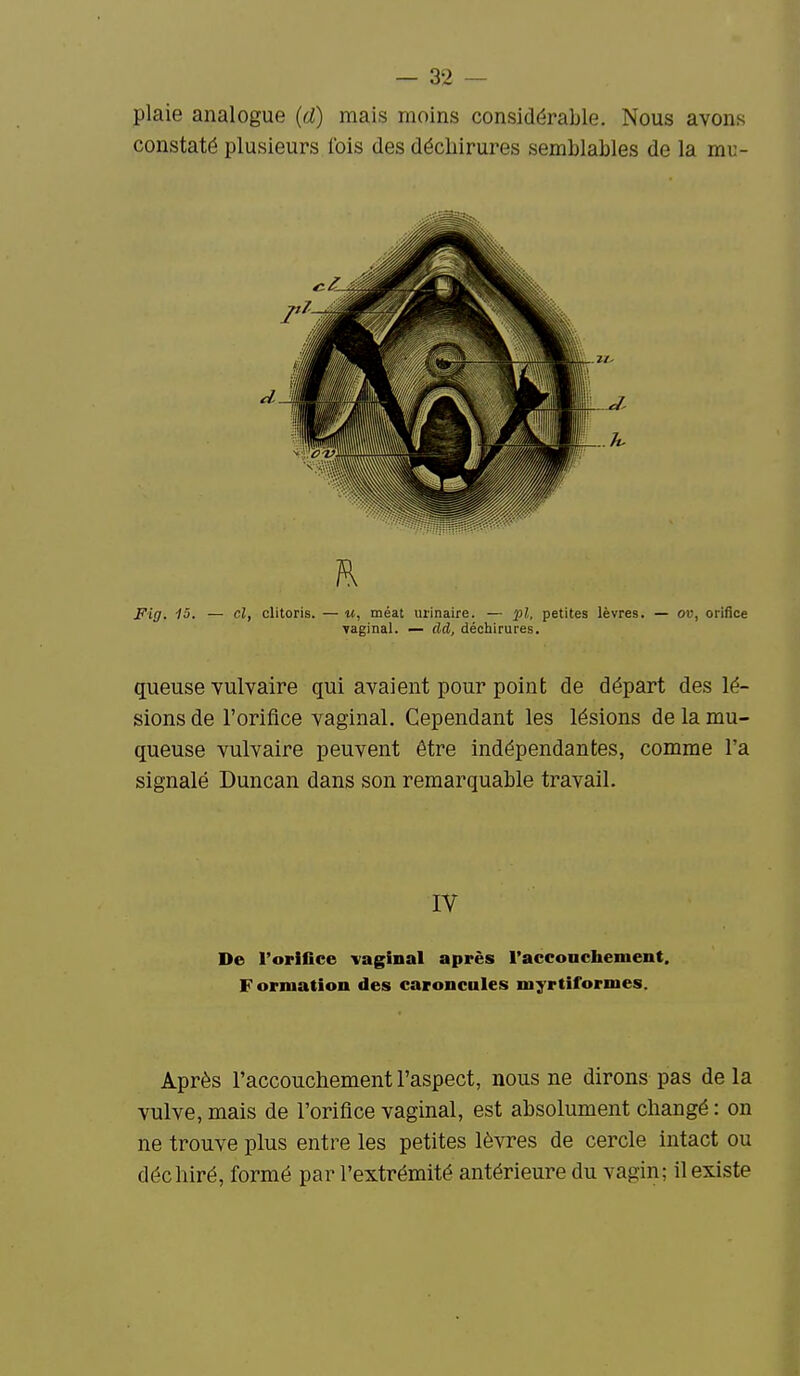 plaie analogue (d) mais moins considérable. Nous avons constaté plusieurs fois des déchirures semblables de la mu- Fig. 1û. — cl, clitoris. — m, méat urinaire. — pl, petites lèvres. — ou, oriUce vaginal. — dd, déchirures. queuse Yulvaire qui avaient pour point de départ des lé- sions de l'orifice vaginal. Cependant les lésions de la mu- queuse vulvaire peuvent être indépendantes, comme l'a signalé Duncan dans son remarquable travail. IV De l'oriflce vaginal après racconchement. Formation des caroncules myrtiformes. Après l'accouchement l'aspect, nous ne dirons pas de la vulve, mais de l'orifice vaginal, est absolument changé : on ne trouve plus entre les petites lèvres de cercle intact ou déchiré, formé par l'extrémité antérieure du vagin; il existe