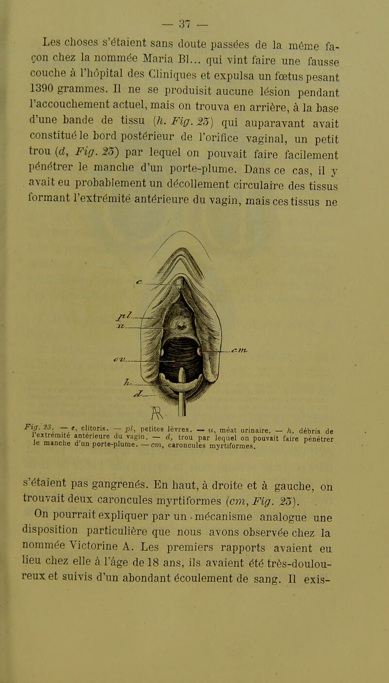 Les choses s'étaient sans doute passées de la même fa- çon chez la nommée Maria Bl... qui vint faire une fausse couche à l'hôpital des Cliniques et expulsa un fœtus pesant 1390 grammes. Il ne se produisit aucune lésion pendant l'accouchement actuel, mais on trouva en arrière, à la hase d'une bande de tissu [h. Fig. 23) qui auparavant avait constitué le bord postérieur de l'orifice vaginal, un petit trou (d, Fig. 23) par lequel on pouvait faire facilement pénétrer le manche d'un porte-plume. Dans ce cas, il y avait eu probablement un décollement circulaire des tissus formant l'extrémité antérieure du vagin, mais ces tissus ne s'étaient pas gangrenés. En haut, à droite et à gauche, on trouvait deux caroncules myrtiformes (cm, Fig. 23). On pourrait expliquer par un • mécanisme analogue une disposition particulière que nous avons observée chez la nommée Victorine A. Les premiers rapports avaient eu H lieu chez elle à l'âge de 18 ans, ils avaient été très-doulou- reux et suivis d'un abondant écoulement de sang. Il exis-