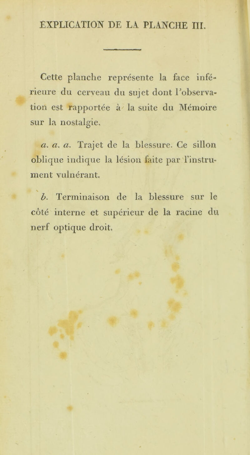 Cette planche représente la face infé- rieure du cerveau du sujet dont Inobserva- tion est rapportée à' la suite du Mémoire sur la nostalgie. a. a. a. Trajet de la blessure. Ce sillon oblique indique la lésion faite par l'instru- ment vulnérant. b. Terminaison de la blessure sur le côté interne et supérieur de la racine du nerf optique droit.