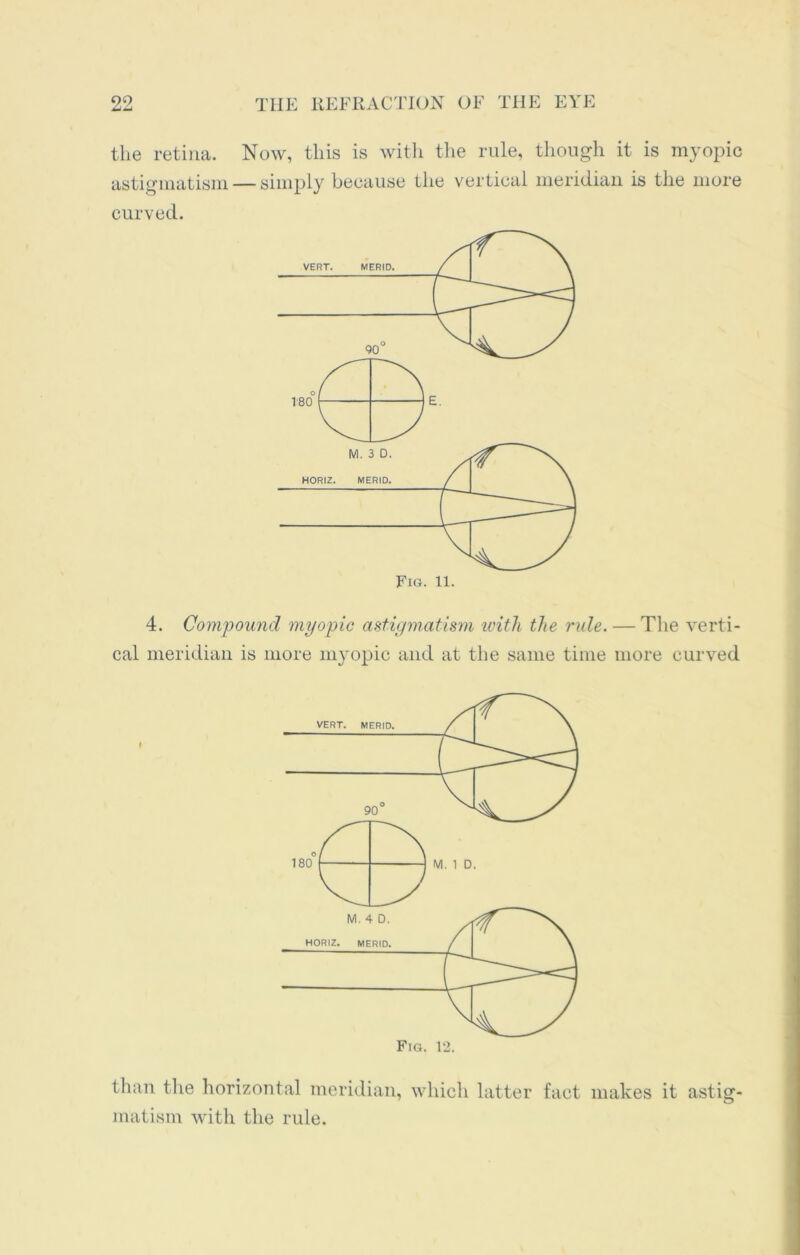 the retina. Now, this is with the rule, though it is myopic astigmatism — simply because the vertical meridian is the more curved. 4. Compound myopic astigmatism with the rule. — The verti- cal meridian is more myopic and at the same time more curved than the horizontal meridian, which latter fact makes it astig- matism with the rule.