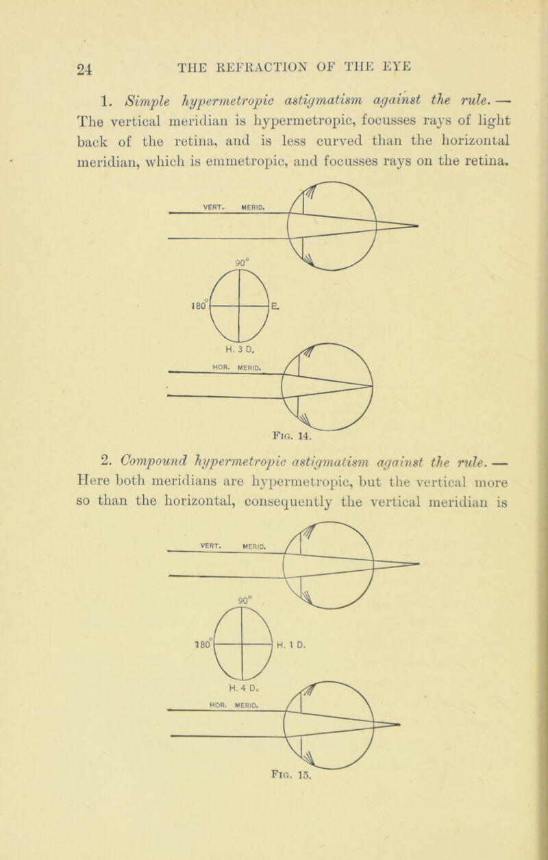1. Simple hypermetropic astigmatism against the rule. — The vertical meridian is hypermetropic, focusses rays of light back of the retina, and is less curved than the horizontal meridian, which is emmetropic, and focusses rays on the retina. 2. Compound hypermetropic astigmatism against the rule. — Here both meridians are hypermetropic, but the vertical more so than the horizontal, consequently the vertical meridian is