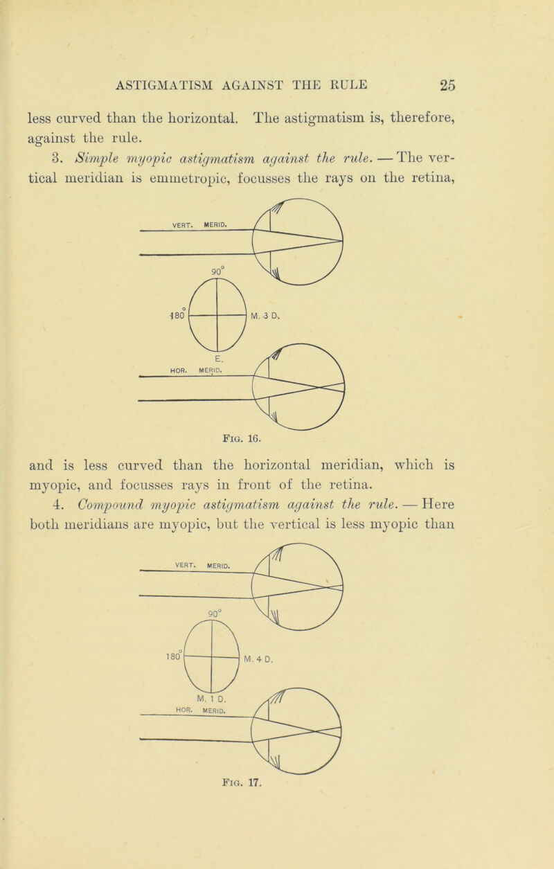 less curved than the horizontal. The astigmatism is, therefore, against the rule. 3. Simple myopic astigmatism against the rule. — The ver- tical meridian is emmetropic, focusses the rays on the retina, Fig. 16. and is less curved than the horizontal meridian, which is myopic, and focusses rays in front of the retina. 4. Compound myopic astigmatism against the rule. — Here both meridians are myopic, but the vertical is less myopic than