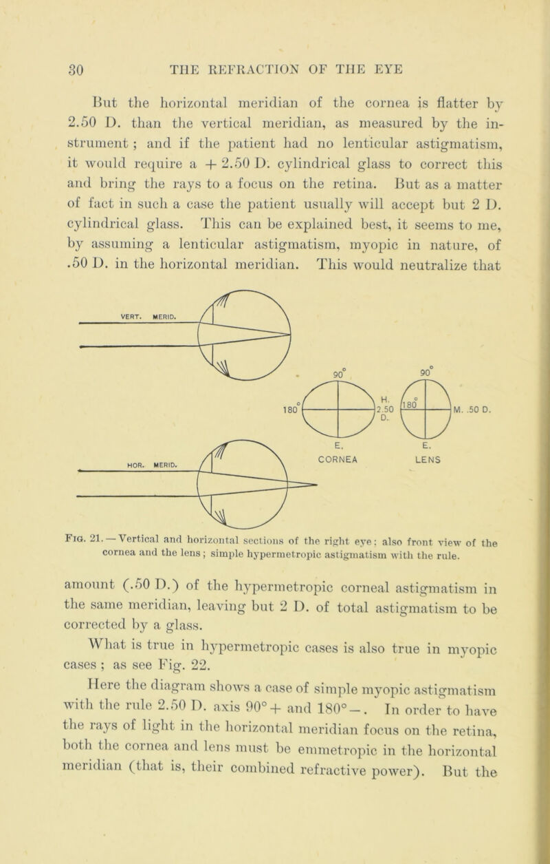 But the horizontal meridian of the cornea is flatter by 2.50 J). than the vertical meridian, as measured by the in- strument ; and if the patient had no lenticular astigmatism, it would require a 4- 2.50 D. cylindrical glass to correct this and bring the rays to a focus on the retina. But as a matter of fact in such a case the patient usually will accept but 2 D. cylindrical glass. This can be explained best, it seems to me, by assuming a lenticular astigmatism, myopic in nature, of .50 D. in the horizontal meridian. This would neutralize that cornea and the lens ; simple hypermetropic astigmatism with the rule. amount (.50 D.) of the hypermetropic corneal astigmatism in the same meridian, leaving but 2 I). of total astigmatism to be corrected by a glass. What is true in hypermetropic cases is also true in myopic cases ; as see Fig. 22. Here the diagram shows a case of simple myopic astigmatism with the rule 2.50 D. axis 90°+ and 180°-.  In order to have the rays of light in the horizontal meridian focus on the retina, both the cornea and lens must be emmetropic in the horizontal meridian (that is, their combined refractive power). But the