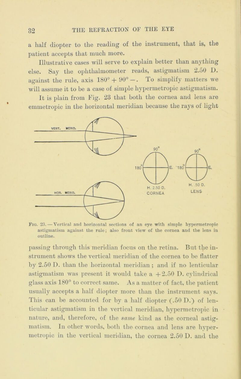 a half diopter to the reading of the instrument, that is, the patient accepts that much more. Illustrative cases will serve to explain better than anything else. Say the ophthalmometer reads, astigmatism 2.50 D. against the rule, axis 180°+ 90°-. To simplify matters we will assume it to be a case of simple hypermetropic astigmatism. It is plain from Fig. 23 that both the cornea and lens are emmetropic in the horizontal meridian because the rays of light 90 LENS Fig. 23.—Vertical and horizontal sections of an eye with simple hypermetropic astigmatism against the rule; also front view of the cornea and the lens in outline. passing through this meridian focus on the retina. But the in- strument shows the vertical meridian of the cornea to be flatter by 2.50 D. than the horizontal meridian ; and if no lenticular astigmatism was present it would take a +2.50 D. cylindrical glass axis 180° to correct same. As a matter of fact, the patient usually accepts a half diopter more than the instrument says. This can be accounted for by a half diopter (.50 D.) of len- ticular astigmatism in the vertical meridian, hypermetropic in nature, and, therefore, of the same kind as the corneal astig- matism. In other words, both the cornea and lens are hyper- metropic in the vertical meridian, the cornea 2.50 D. and the