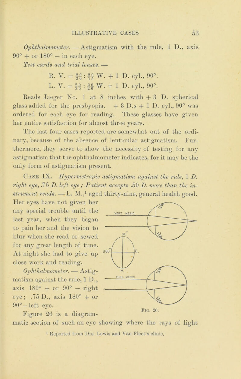 Ophthalmometer.—Astigmatism with the rule, 1 D., axis 90° + or 180° — in each eye. Test cards and trial lenses. — R. V. - ff: W. + 1 D. cyl., 90°. L. V. = ff : f-f W. + 1 D. cyl., 90°. Reads Jaeger No. 1 at 8 inches with + 3 I), spherical glass added for the presbyopia. + 3 D.s + 1 D. cyl., 90° was ordered for each eye for reading. These glasses have given her entire satisfaction for almost three years. The last four cases reported are somewhat out of the ordi- nary, because of the absence of lenticular astigmatism. Fur- thermore, they serve to show the necessity of testing for any astigmatism that the ophthalmometer indicates, for it may be the only form of astigmatism present. Case IX. Hypermetropic astigmatism against the rule, 1 D. right eye, .75 I), left eye ; Patient accepts .50 I). more than the in- strument reads. — L. M.,1 aged thirty-nine, general health good. Her eyes have not given her any special trouble until the last year, when they began to pain her and the vision to blur when she read or sewed for any great length of time. At night she had to give up close work and reading. Ophthalmometer. — Astig- matism against the rule, II)., axis 180° + or 90° — right eye; .75 D., axis 180° -f- or 90° — left eye. Figure 26 is a diagram- matic section of such an eye showing where the rays of light 1 Reported from Drs. Lewis and Van Fleet’s clinic.