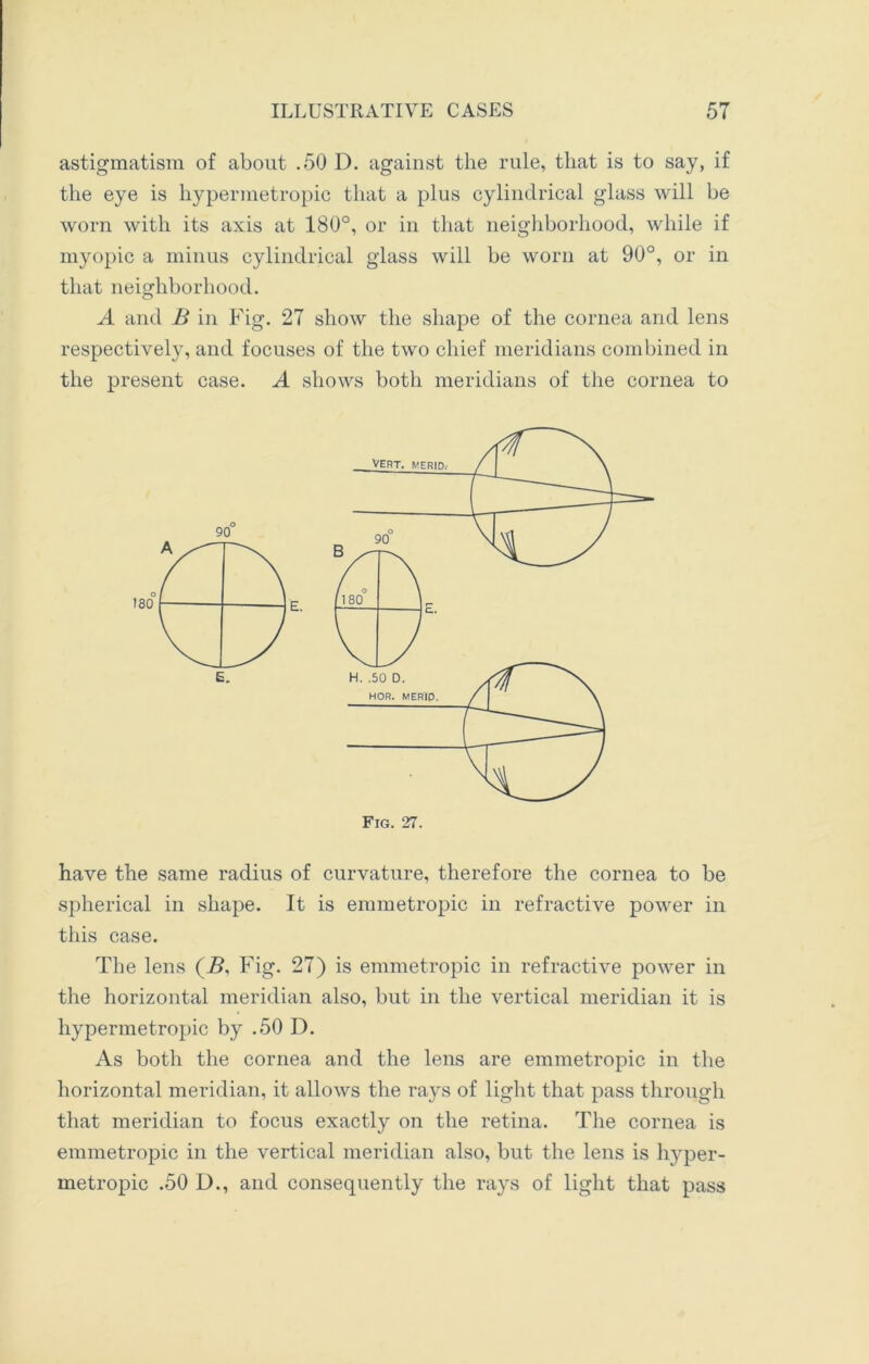 astigmatism of about .50 D. against the rule, that is to say, if the eye is hypermetropic that a plus cylindrical glass will be worn with its axis at 180°, or in that neighborhood, while if myopic a minus cylindrical glass will be worn at 90°, or in that neighborhood. A and B in Fig. 27 show the shape of the cornea and lens respectively, and focuses of the two chief meridians combined in the present case. A shows both meridians of the cornea to have the same radius of curvature, therefore the cornea to be spherical in shape. It is emmetropic in refractive power in this case. The lens (J9, Fig. 27) is emmetropic in refractive power in the horizontal meridian also, but in the vertical meridian it is hypermetropic by .50 D. As both the cornea and the lens are emmetropic in the horizontal meridian, it allows the rays of light that pass through that meridian to focus exactly on the retina. The cornea is emmetropic in the vertical meridian also, but the lens is hyper- metropic .50 D., and consequently the rays of light that pass