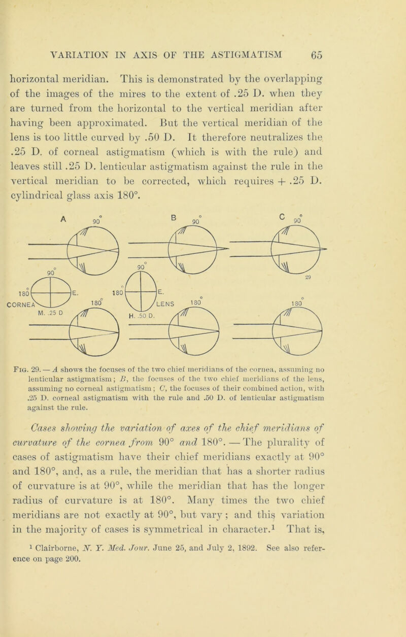 horizontal meridian. This is demonstrated by the overlapping of the images of the mires to the extent of .25 D. when they are turned from the horizontal to the vertical meridian after having been approximated. But the vertical meridian of the lens is too little curved by .50 D. It therefore neutralizes the .25 D. of corneal astigmatism (which is with the rule) and leaves still .25 D. lenticular astigmatism against the rule in the vertical meridian to be corrected, which requires + .25 D. cylindrical glass axis 180°. A 90° B 90 C 90 Fig. 29. — A shows the focuses of the two chief meridians of the cornea, assuming no lenticular astigmatism; B, the focuses of the two chief meridians of the lens, assuming no corneal astigmatism; C, the focuses of their combined action, with .25 D. corneal astigmatism with the rule and .50 D. of lenticular astigmatism against the rule. Cases shelving the variation of axes of the chief meridians of curvature of the cornea from 90° and 180°. — The plurality of cases of astigmatism have their chief meridians exactly at 90° and 180°, and, as a rule, the meridian that has a shorter radius of curvature is at 90°, while the meridian that has the longer radius of curvature is at 180°. Many times the two chief meridians are not exactly at 90°, but vary; and this variation in the majority of cases is symmetrical in character.1 That is, 1 Clairborne, N. Y. Med. Jour. June 25, and July 2, 1892. See also refer- ence on page 200.