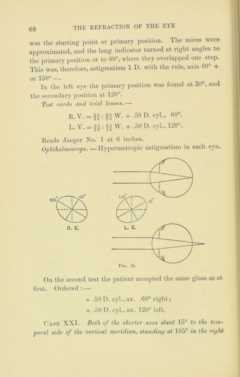 was the starting point or primary position. The mires were approximated, and the long indicator turned at light angles to the primary position or to 60°, where they overlapped one step. This was, therefore, astigmatism 1 D. with the rule, axis 60° + or 150°-. In the left eye the primary position was found at 80°, and the secondary position at 120°. Test cards and trial lenses.— R.v. + .50D. cyl., 60°. L. V. = |i: ft W. + .50 D. cyl., 120°. Reads Jaeger No. 1 at 6 inches. Ophthalmoscope.—Hypermetropic astigmatism in each e}e. On the second test the patient accepted the same glass as at first. Ordered : — -f- .50 D. cyl., ax. .60° right; -p .50 I), cyl., ax. 120° left. Case XXI. Both of the shorter axes slant 15° to the tem- poral side of the vertical meridian, standing at 105° in the right