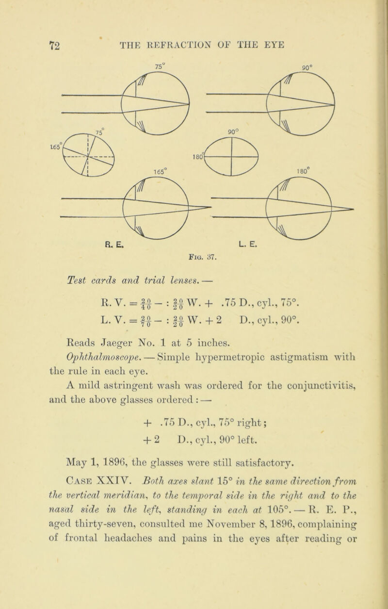 75° 90° Fig. 37. Test cards and trial lenses. — R. V. = |o _ : W. + .75 D., cyl., 75°. L. V. = fA _ : |o W. + 2 D., cyl., 90°. Reads Jaeger No. 1 at 5 inches. Ophthalmoscope. — Simple hypermetropic astigmatism with the rule in each eye. A mild astringent wash was ordered for the conjunctivitis, and the above glasses ordered : — -f- .75 D., c}d., 75° right; + 2 D., cyl., 90° left. May 1, 1896, the glasses were still satisfactory. Case XXIV. Both axes slant 15° in the same direction from the vertical meridian, to the temporal side in the right and to the nasal side in the left, standing in each at 105°. — R. E. P., aged thirty-seven, consulted me November 8, 1896, complaining of frontal headaches and pains in the eyes after reading or
