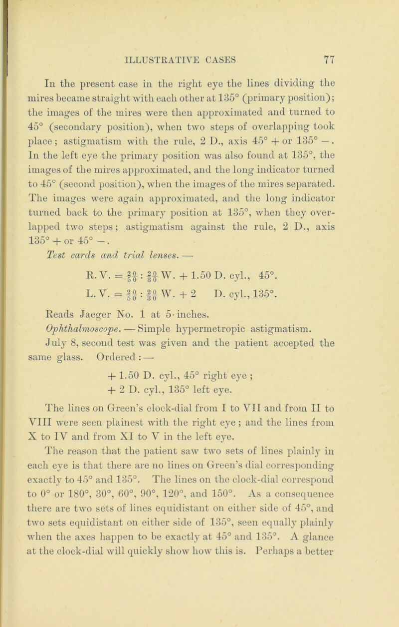 In the present case in the right eye the lines dividing the mires became straight with each other at 135° (primary position); the images of the mires were then approximated and turned to 45° (secondary position), when two steps of overlapping took place; astigmatism with the rule, 2 D., axis 45° + or 135° —. In the left eye the primary position was also found at 135°, the images of the mires approximated, and the long indicator turned to 45° (second position), when the images of the mires separated. The images were again approximated, and the long indicator turned back to the primary position at 135°, when they over- lapped two steps; astigmatism against the rule, 2 D., axis 135° + or 45° —. Test cards arid trial lenses. — R. V. = : |o W. + 1.50 L). cyl., 45°. L-V- =M:UW- + 2 D. cyl., 135°. Reads Jaeger No. 1 at 5-inches. Ophthalmoscope. — Simple hypermetropic astigmatism. J uly 8, second test was given and the patient accepted the same glass. Ordered : — + 1.50 D. cyl., 45° right eye ; •f 2 D, cyl., 135° left eye. The lines on Green’s clock-dial from I to VII and from II to VIII were seen plainest with the right eye ; and the lines from X to IV and from XI to V in the left eye. The reason that the patient saw two sets of lines plainly in each eye is that there are no lines on Green’s dial corresponding exactly to 45° and 135°. The lines on the clock-dial correspond to 0° or 180°, 30°, 60°, 90°, 120°, and 150°. As a consequence there are two sets of lines equidistant on either side of 45°, and two sets equidistant on either side of 135°, seen equally plainly when the axes happen to be exactly at 45° and 135°. A glance at the clock-dial will quickly show how this is. Perhaps a better