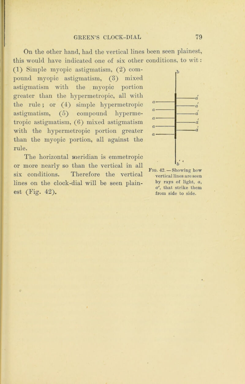 -a / -a On the other hand, had the vertical lines been seen plainest, this would have indicated one of six other conditions, to wit: (1) Simple myopic astigmatism, (2) com- pound myopic astigmatism, (3) mixed astigmatism with the myopic portion greater than the hypermetropic, all with the rule; or (4) simple hypermetropic astigmatism, (5) compound hyperme- • • • , _ , , Cl tropic astigmatism, (6) mixed astigmatism with the hypermetropic portion greater than the myopic portion, all against the rule. The horizontal meridian is emmetropic or more nearly so than the vertical in all ... . Fig. 42. — Showing how SIX conditions. Therefore the vertical vertical lines are seen lines on the clock-dial will be seen plain- rays of a< a', that strike them est (T lg. 4*j). from side to side.
