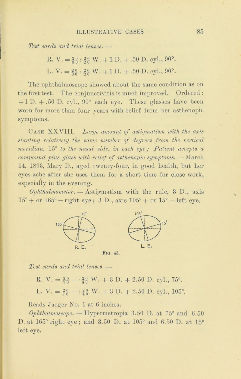 Test cards and tried lenses. — R. V. = 20.; |o w. +1 D. + .50 D. cyl., 90°. L. V. = W. + 1 I). + .50 I), cyl., 90°. The ophthalmoscope showed about the same condition as on the first test. The conjunctivitis is much improved. Ordered: + 1 D. +.50 D. cyl., 90° each eye. These gdasses have been worn for more than four years with relief from her asthenopic symptoms. Case XXYIII. Large amount of astigmatism with the axis slanting relatively the same number of degrees from the vertical meridian, 15° to the nasal side, in each eye; Patient accepts a compound plus glass with relief of asthenopic symptoms. — March 14, 1893, Mary D., aged twenty-four, in good health, but her eyes ache after she uses them for a short time for close work, especially in the evening. Ophthalmometer. — Astigmatism with the rule, 3 D., axis 75° + or 165° — right eye ; 3D., axis 105° + or 15° — left eye. 75° Fig. 43. 105 Test cards and trial lenses. — R. V. = f# - : -§£ W. + 3 D. + 2.50 D. cyl., 75°. L. V. = f# - : f-g W. + 3 I). + 2.50 D. cyl., 105°. Reads Jaeger No. 1 at 6 inches. Ophthalmoscope.—Hypermetropia 3.50 D. at 75° and 6.50 D. at 165° right eye; and 3.50 D. at 105° and 6.50 D. at 15° left eye. *