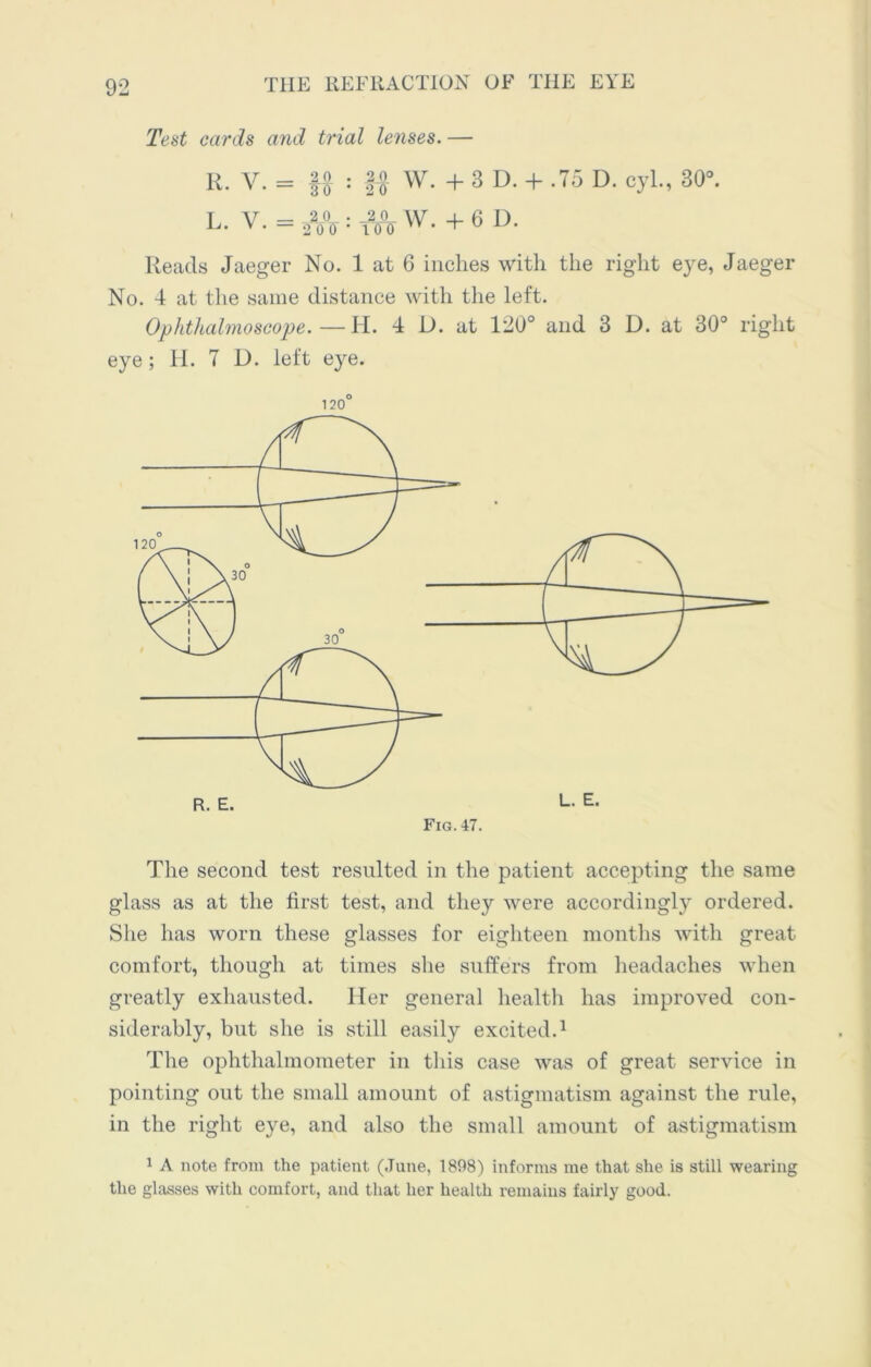 Test cards and trial lenses. — R. V. = ff : ft W. +3D. + .75 D. cyl., 30°. I V — 2 Ac- • -2-2- W 4-6 I ) v’ — 200- 100 >v,'u 1 ' Reads Jaeger No. 1 at 6 inches with the right eye, Jaeger No. 4 at the same distance with the left. Ophthalmoscope.—H. 4 D. at 120° and 3 D. at 30° right eye ; H. 7 U. left eye. 120° The second test resulted in the patient accepting the same glass as at the first test, and they were accordingly ordered. She has worn these glasses for eighteen months with great comfort, though at times she suffers from headaches when greatly exhausted. Her general health has improved con- siderably, but she is still easily excited.1 The ophthalmometer in this case was of great service in pointing out the small amount of astigmatism against the rule, in the right eye, and also the small amount of astigmatism 1 A note from the patient (June, 1898) informs me that she is still wearing the glasses with comfort, and that her health remains fairly good.
