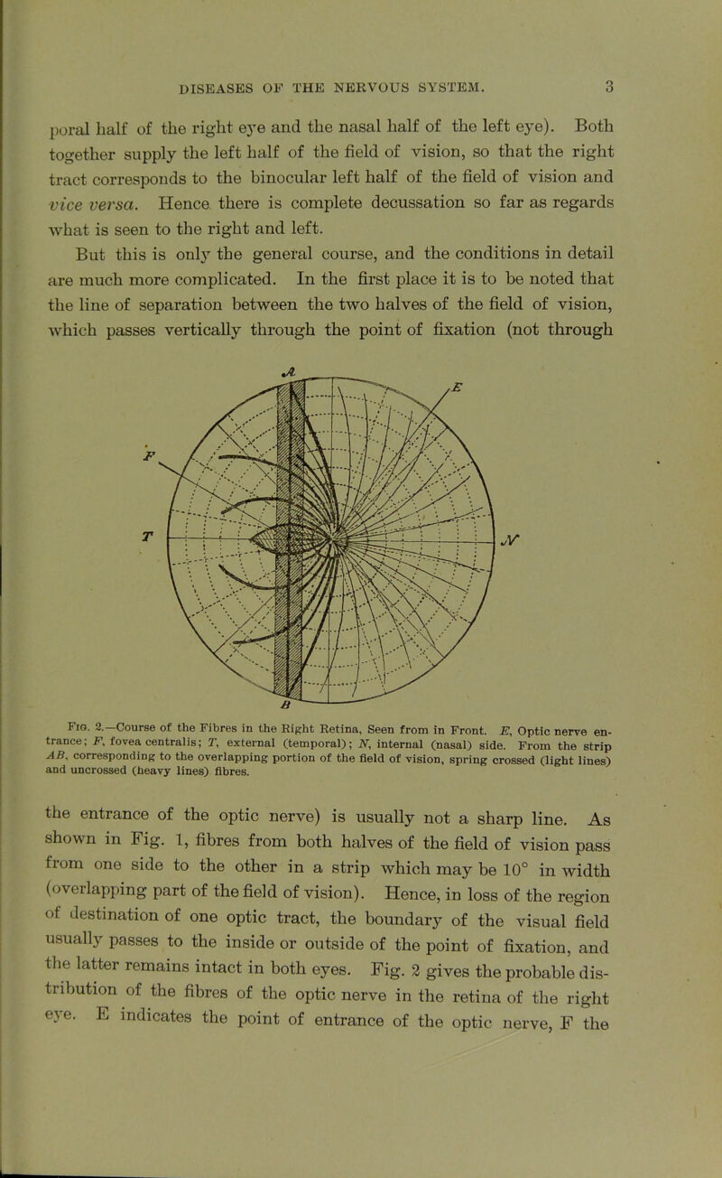 poral half of the right eye and the nasal half of the left eye). Both together supply the left half of the field of vision, so that the right tract corresponds to the binocular left half of the field of vision and vice versa. Hence, there is complete decussation so far as regards what is seen to the right and left. But this is only the general course, and the conditions in detail are much more complicated. In the first place it is to be noted that the line of separation between the two halves of the field of vision, which passes vertically through the point of fixation (not through Fig. 2.—Course of the Fibres in the Right Retina, Seen from in Front. E, Optic nerve en- trance; F, fovea centralis; T, external (temporal); N, internal (nasal) side. From the strip AB, corresponding to the overlapping portion of the field of vision, spring crossed (light lines) and uncrossed (heavy lines) fibres. the entrance of the optic nerve) is usually not a sharp line. As shown in big. 1, fibres from both halves of the field of vision pass from one side to the other in a strip which may be 10° in width (overlapping part of the field of vision). Hence, in loss of the region of destination of one optic tract, the boundary of the visual field usually passes to the inside or outside of the point of fixation, and the latter remains intact in both eyes. Fig. 2 gives the probable dis- tribution of the fibres of the optic nerve in the retina of the right eye. E indicates the point of entrance of the optic nerve, F the