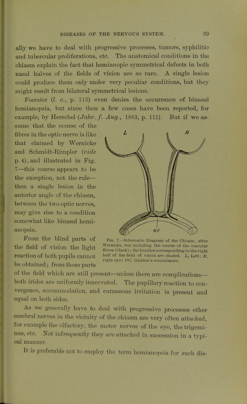 ally we have to deal with progressive processes, tumors, syphilitic and tubercular proliferations, etc. The anatomical conditions in the chiasm explain the fact that hemianopic symmetrical defects in both nasal halves of the fields of vision are so rare. A single lesion could produce them only under very peculiar conditions, but they might result from bilateral symmetrical lesions. Foerster (Z. c., p. 113) even denies the occurrence of binasal hemianopsia, but since then a few cases have been reported, for example, by Herschel (Jalir. f. Aug., 1883, p. 111). But if we as- sume that the course of the fibres in the optic nerve is like that claimed by Wernicke and Schmidt-Rimpler (vide p. 4), and illustrated in Fig. 7—this course appears to be the exception, not the rule— then a single lesion in the anterior angle of the chiasm, between the two optic nerves, may give rise to a condition somewhat like binasal hemi- anopsia. From the blind parts of the field of vision the light reaction of both pupils cannot be obtained; from those parts Fig. 7.—Schematic Diagram of the Chiasm, after Wernicke, but including the course of the macular fibres (black) ; the bundles corresponding to the right half of the field of vision are shaded. L, Left; R, right eye; GC, Qudden’s commissure. of the field which are still present—unless there are complications— both irides are uniformly innervated. The pupillary reaction to con- vergence, accommodation, and cutaneous irritation is present and equal on both sides. As we generally have to deal with progressive processes other cerebral nerves in the vicinity of the chiasm are very often attacked, for example the olfactory, the motor nerves of the eye, the trigemi- nus, etc. Not infrequently they are attacked in succession in a typi- cal manner. It is preferable not to employ the term hemianopsia for such dis-