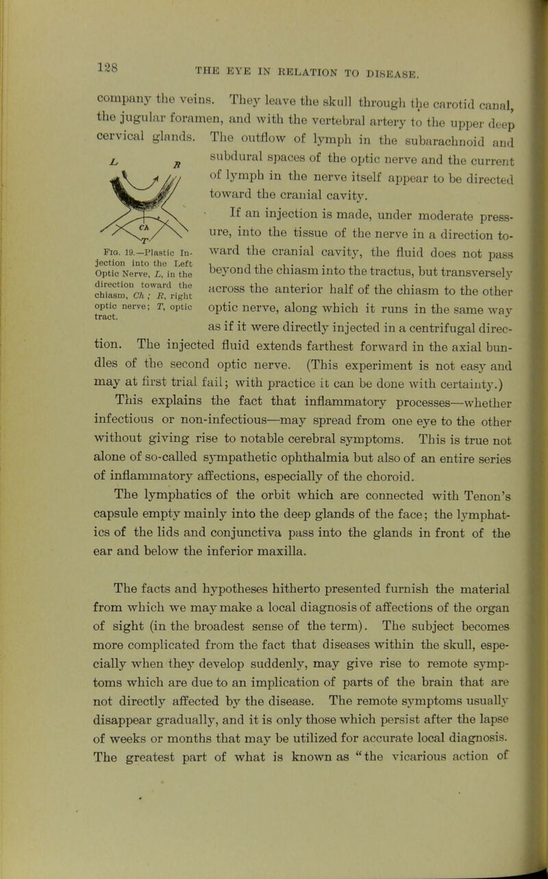 Fig. 19.—Plastic In- jection into the Left Optic Nerve, L, in the direction toward the chiasm, Ch ; R, right optic nerve; T, optic tract. company the veins. They leave the skull through the carotid canal, the jugular foramen, and with the vertebral artery to the upper deep cervical glands. The outflow of lymph in the subarachnoid and subdural spaces of the optic nerve and the current of lymph in the nerve itself appear to he directed toward the cranial cavity. If an injection is made, under moderate press- ure, into the tissue of the nerve in a direction to- ward the cranial cavity, the fluid does not pass bej^ond the chiasm into the tractus, but transversely across the anterior half of the chiasm to the other optic nerve, along which it runs in the same way as if it were directly injected in a centrifugal direc- tion. The injected fluid extends farthest forward in the axial bun- dles of the second optic nerve. (This experiment is not easy and may at first trial fail; with practice it can be done with certainty.) This explains the fact that inflammatory processes—whether infectious or non-infectious—may spread from one eye to the other without giving rise to notable cerebral symptoms. This is true not alone of so-called sympathetic ophthalmia but also of an entire series of inflammatory affections, especially of the choroid. The lymphatics of the orbit which are connected with Tenon’s capsule empty mainly into the deep glands of the face; the lymphat- ics of the lids and conjunctiva pass into the glands in front of the ear and below the inferior maxilla. The facts and hypotheses hitherto presented furnish the material from which we may make a local diagnosis of affections of the organ of sight (in the broadest sense of the term). The subject becomes more complicated from the fact that diseases within the skull, espe- cially when they develop suddenly, may give rise to remote symp- toms which are due to an implication of parts of the brain that are not directly affected by the disease. The remote symptoms usually disappear gradually, and it is only those which persist after the lapse of weeks or months that may be utilized for accurate local diagnosis. The greatest part of what is known as “ the vicarious action of