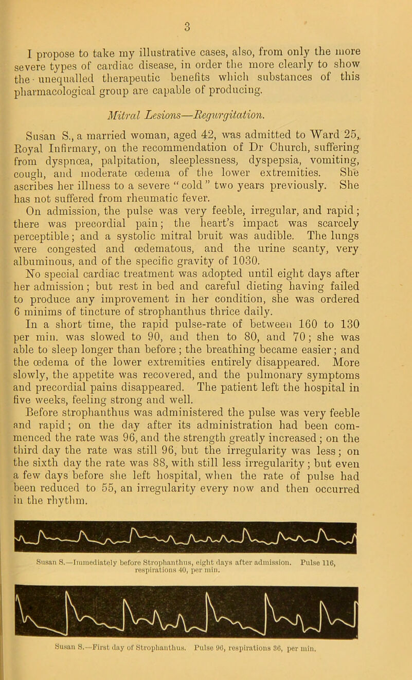 I propose to take my illustrative cases, also, from only the more severe types of cardiac disease, in order the more clearly to show the • unequalled therapeutic benefits which substances of this pharmacological group are capable of producing. Mitred Lesions—Regurgitation. Susan S., a married woman, aged 42, was admitted to Ward 25,, Royal Infirmary, on the recommendation of Dr Church, suffering from dyspnoea, palpitation, sleeplessness, dyspepsia, vomiting, cough, and moderate oedema of the lower extremities. She ascribes her illness to a severe “cold” two years previously. She has not suffered from rheumatic fever. On admission, the pulse was very feeble, irregular, and rapid; there was precordial pain; the heart’s impact was scarcely perceptible; and a systolic mitral bruit was audible. The lungs were congested and oedematous, and the urine scanty, very albuminous, and of the specific gravity of 1030. No special cardiac treatment was adopted until eight days after her admission; but rest in bed and careful dieting having failed to produce any improvement in her condition, she was ordered 6 minims of tincture of strophanthus thrice daily. In a short time, the rapid pulse-rate of between 160 to 130 per min. was slowed to 90, and then to 80, and 70; she was able to sleep longer than before; the breathing became easier; and the oedema of the lower extremities entirely disappeared. More slowly, the appetite was recovered, and the pulmonary symptoms and precordial pains disappeared. The patient left the hospital in five weeks, feeling strong and well. Before strophanthus was administered the pulse was very feeble and rapid ; on the day after its administration had been com- menced the rate was 96, and the strength greatly increased ; on the third day the rate was still 96, but the irregularity was less; on the sixth day the rate was 88, with still less irregularity; but even a few days before she left hospital, when the rate of pulse had been reduced to 55, an irregularity every now and then occurred iu the rhythm. Susan S.— First day of Strophanthus. Pulse 90, respirations 30, per min.