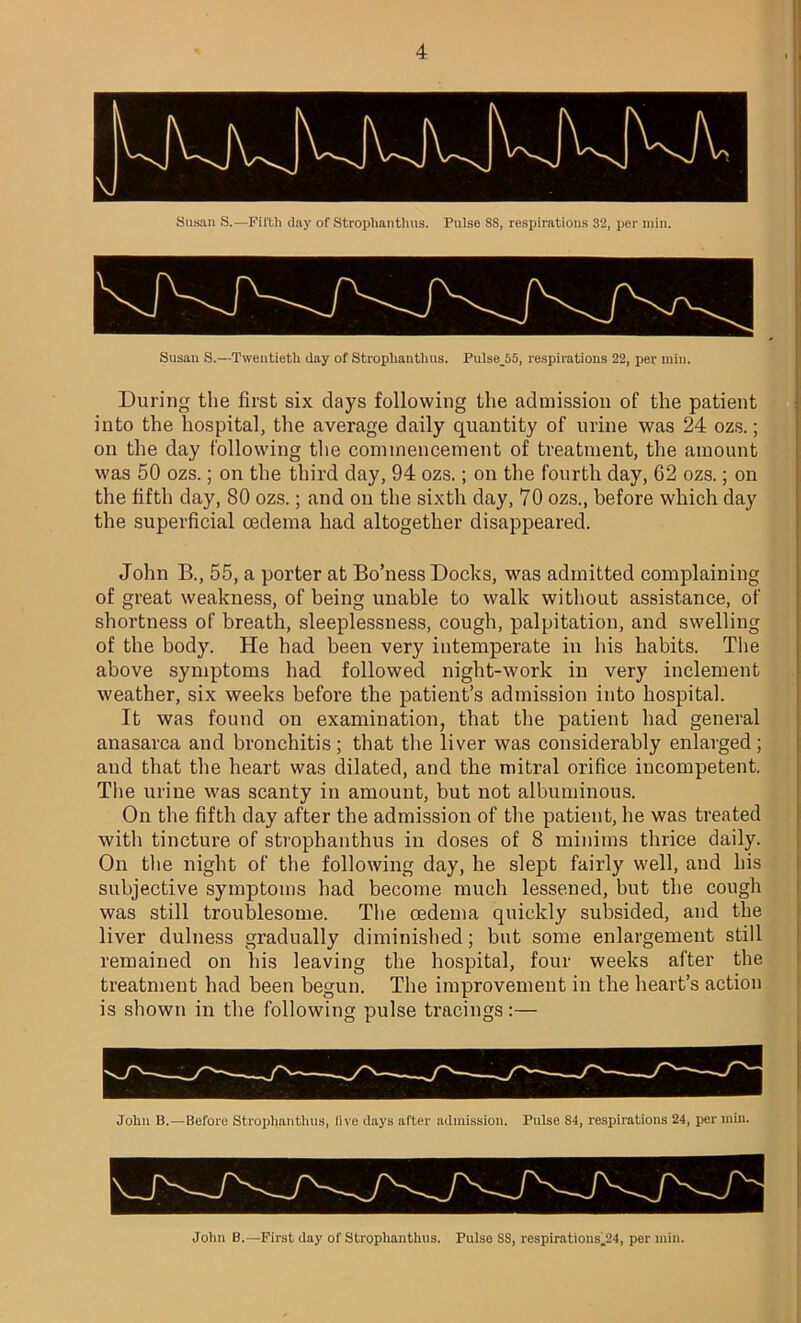 Susan S.—Fifth day of Strophantlnis. Pulse 88, respirations 32, per min. Susan S.—Twentieth day of Stroplianthus. Pulse_55, respirations 22, per min. During the first six days following the admission of the patient into the hospital, the average daily quantity of urine was 24 ozs.; on the day following the commencement of treatment, the amount was 50 ozs.; on the third day, 94 ozs.; on the fourth day, 62 ozs.; on the fifth day, 80 ozs.; and on the sixth day, 70 ozs., before which day the superficial oedema had altogether disappeared. John B., 55, a porter at Bo’ness Docks, was admitted complaining of great weakness, of being unable to walk without assistance, of shortness of breath, sleeplessness, cough, palpitation, and swelling of the body. He had been very intemperate in his habits. The above symptoms had followed night-work in very inclement weather, six weeks before the patient’s admission into hospital. It was found on examination, that the patient had general anasarca and bronchitis; that the liver was considerably enlarged; and that the heart was dilated, and the mitral orifice incompetent. The urine was scanty in amount, but not albuminous. On the fifth day after the admission of the patient, he was treated with tincture of stroplianthus in doses of 8 minims thrice daily. On the night of the following day, he slept fairly well, and his subjective symptoms had become much lessened, but the cough was still troublesome. The oedema quickly subsided, and the liver dulness gradually diminished; but some enlargement still remained on his leaving the hospital, four weeks after the treatment had been begun. The improvement in the heart’s action is shown in the following pulse tracings:— John B.—Before Stroplianthus, five days after admission. Pulse St, respirations 24, per min.