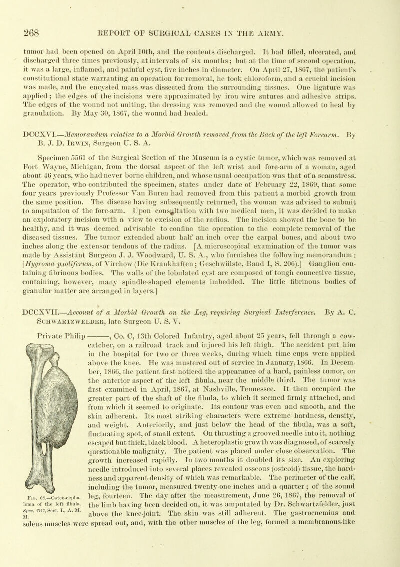 tumor liiul been opened ou April lOtli, and the contents discharged. It bad filled, ulcerated, and discharged three times previously, at intervals of six months; but at the time of second operation, it was a large, inflamed, and painful cj'st, five inches in diameter. On April 27, 18G7, the patient's constitutional state warranting an operation for removal, he took chloroform, and a crucial incision was made, and the encysted mass was dissected from the surrounding tissues. One ligature was applied; the edges of the incisions were approximated by iron wire sutures and adhesive strips. The edges of the wound not uniting, the d]-essing was removed and the wound allowed to heal by granulation. By May 30, 1867, the wound had healed. DCOXVI.—Memorandum relative to a Morbid Growth removed from the Bach of the left Forearm. By B. J. I). Irwin, Surgeon U. S. A. Specimen 55G1 of the Surgical Section of the Museum is a cystic tumor, which was removed at Fort Wayne, Michigan, from the dorsal aspect of the left wrist and fore-arm of a woman, aged about 40 years, who had never borne children, and whose usual occupation Avas that of a seamstress. The operator, who contributed the specimen, states under date of February 22, 1869, that some four years previously Professor Van Buren had removed from this patient a morbid growth from the same i)osition. The disease having subsequently returned, the woman was advised to submit to amputation of the fore-arm. Upon consultation with two medical men, it was decided to make an exploratory incision with a view to excision of the radius. The incision showed the bone to be healthy, and it was deemed advisable to confine the operation to the complete removal of the diseased tissues. The tumor extended about half an inch over the carpal bones, and about two inches along the extensor tendons of the radius. [A microscopical examination of the tumor was made by Assistant Surgeon J. J. Woodward, U. S. A., who furnishes the folloM'ing memorandum : [Uyqroma i)Mlifcrum^ of Yirchow (Die Krankhaften; Geschwiilste, Band I, S. 206).] Ganglion con- taining fibrinous bodies. The walls of the lobulated cyst are composed of tough connective tissue, containing, however, maiiy spindle-shaped elements imbedded. The little fibrinous bodies of granular matter are arranged in layers.] DCCXVII.—Account of a Morbid Growth on the Leg, requiring Surgical Interference. ScHWAETZWELDER, late Surgcon TJ. S. V. By A. C. Private Philii) —, Co. C, 13th Colored Infantry, aged about 25 years, fell through a cow- catcher, on a railroad track and iiijured his left thigh. The accident put him in the hospital for two or three weeks, during which time cups were applied above the knee. He was mustered out of service in January, 1866. In Decem- ber, 1866, the patient first noticed the appearance of a hard, painless tumor, on the anterior aspect of the left fibula, near the middle third. The tumor was first examined in April, 1867, at Nashville, Tennessee. It then occupied the greater part of the shaft of the fibula, to which it seemed firmly attached, and from which it seemed to originate. Its contour was even and smooth, and the skin adherent. Its most striking characters were extreme hardness, density, and weight. Anteriorily, and just below the head of the fibula, was a soft, fluctuating spot, of small extent. Ou thrusting a grooved needle into it, nothing escaped but thick, black blood. A heteroplastic growth was diagnosed, of scarcely questionable malignity. The patient was placed under close observation. The growth increased rapidly. In two months it doubled its size. An exploring needle introduced into several i^laces revealed osseous (osteoid) tissue, the hard- ness and apparent density of which was remarkable. The perimeter of the calf, including the tumor, measured twenty-one inches and a quarter ; of the sound leg, fourteen. The day after the measurement, June 26, 1867, the removal of the limb having been decided on, it was amputated by Dr. Schwartzfelder, just above the knee-joint. The skin was still adherent. The gastrocnemius and soleus muscles were spread out, and, with the other muscles of the leg, formed a membranous-like Fig. CP.—Osteo-cepba- loma of the left fibula. Spec. 4747, Sect. I., A. M. M.