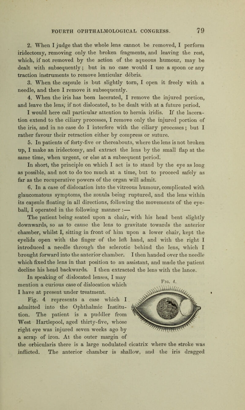 2. When I judge that the whole lens cannot be removed, I perform iridectomy, removing only the broken fragments, and leaving the rest, which, if not removed by the action of the aqueous humour, may be dealt with subsequently; but in no case would I use a spoon or any traction instruments to remove lenticular debris. 3. When the capsule is but slightly torn, I open it freely with a needle, and then I remove it subsequently. 4. When the iris has been lacerated, I remove the injured portion, and leave the lens, if not dislocated, to be dealt with at a future period. I would here call particular attention to hernia iridis. If the lacera- tion extend to the ciliary processes, I remove only the injured portion of the iris, and in no case do I interfere with the ciliary processes; but I rather favour their retraction either by compress or suture. 5. In patients of forty-five or thereabouts, where the lens is not broken up, I make an iridectomy, and extract the lens by the small flap at the same time, when urgent, or else at a subsequent period. In short, the principle on which I act is to stand by the eye as long as possible, and not to do too much at a time, but to proceed safely as far as the recuperative powers of the organ will admit. 6. In a case of dislocation into the vitreous humour, complicated with glaucomatous symptoms, the zonula being ruptured, and the lens within its capsule floating in all directions, following the movements of the eye- ball, I operated in the following manner :— The patient being seated upon a chair, with his head bent slightly downwards, so as to cause the lens to gravitate towards the anterior chamber, whilst I, sitting in front of him upon a lower chair, kept the eyelids open with the finger of the left hand, and with the right I introduced a needle through the sclerotic behind the lens, which I brought forward into the anterior chamber. I then handed over the needle which fixed the lens in that position to an assistant, and made the patient decline his head backwards. I then extracted the lens with the lance. In speaking of dislocated lenses, I may mention a curious case of dislocation which I have at present under treatment. Fig. 4 represents a case which I admitted into the Ophthalmic Institu- tion. The patient is a puddler from West Hartlepool, aged thirty-five, whose right eye was injured seven weeks ago by a scrap of iron. At the outer margin of the orbicularis there is a large nodulated cicatrix where the stroke was inflicted. The anterior chamber is shallow, and the iris dragged Fra. 4.