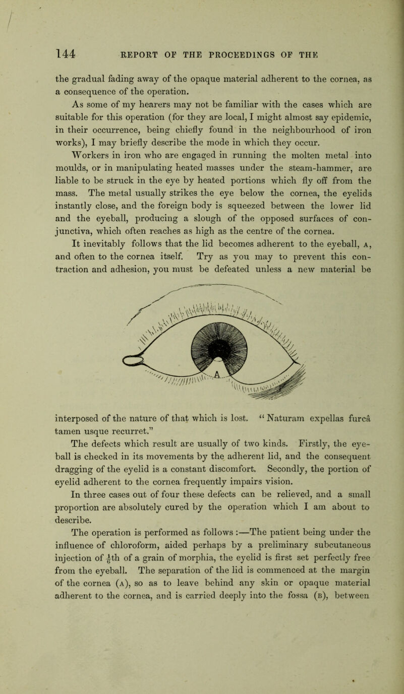 the gradual fading away of the opaque material adherent to the cornea, as a consequence of the operation. As some of my hearers may not be familiar with the cases which are suitable for this operation (for they are local, I might almost say epidemic, in their occurrence, being chiefly found in the neighbourhood of iron works), I may briefly describe the mode in which they occur. Workers in iron who are engaged in running the molten metal into moulds, or in manipulating heated masses under the steam-hammer, are liable to be struck in the eye by heated portions which fly off from the mass. The metal usually strikes the eye below the cornea, the eyelids instantly close, and the foreign body is squeezed between the lower lid and the eyeball, producing a slough of the opposed surfaces of con- junctiva, which often reaches as high as the centre of the cornea. It inevitably follows that the lid becomes adherent to the eyeball, a, and often to the cornea itself. Try as you may to prevent this con- traction and adhesion, you must be defeated unless a new material be interposed of the nature of that which is lost. “ Naturam expellas furcS, tamen usque recurret.” The defects which result are usually of two kinds. Firstly, the eye- ball is checked in its movements by the adherent lid, and the consequent dragging of the eyelid is a constant discomfort. Secondly, the portion of eyelid adherent to the cornea frequently impairs vision. In three cases out of four these defects can be relieved, and a small proportion are absolutely cured by the operation which I am about to describe. The operation is performed as follows :—The patient being under the influence of chloroform, aided perhaps by a preliminary subcutaneous injection of ^th of a grain of morphia, the eyelid is first set perfectly free from the eyeball. The separation of the lid is commenced at the margin of the cornea (a), so as to leave behind any skin or opaque material adherent to the cornea, and is carried deeply into the fossa (b), between