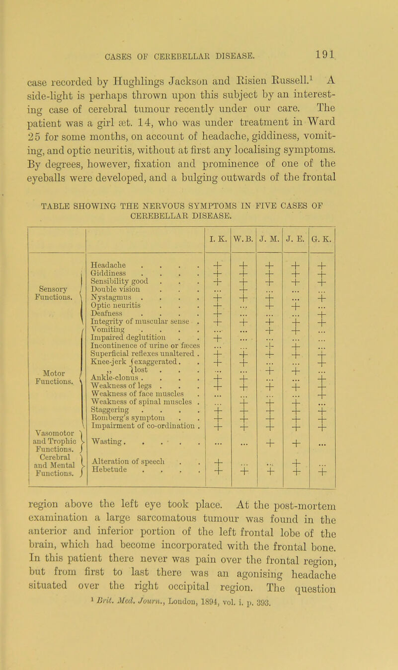 case recorded by Huglilings Jackson and Eisien Eussell.^ A side-light is perhaps thrown upon this subject by an interest- ing case of cerebral tumour recently under our care. The patient was a girl eet. 14, who was under treatment in Ward 25 for some months, on account of headache, giddiness, vomit- ing, and optic neuritis, without at first any localising symptoms. By degrees, however, fixation and prominence of one of the eyeballs were developed, and a bulging outwards of the frontal TABLE SHOWING THE NEKVOUS SYMPTOMS IN FIVE CASES OF CEKEBELLAE DISEASE. I. K. W.B. J. M. J. E. G. K. Headache .... + + 4- . Giddiness .... -f 4- 4- Sensibility good + 4- + Sensory / Double vision Functions. \ Nystagmus .... + + , 4- Optic neuritis -h + 4- , ( Deafness .... Integrity of muscular sense . Vomiting .... + + + + -P i + + Impaired deglutition + Incontinence of urine or feces Superficial reflexes unaltered . + + + 4- -f -I r Knee-jerk J exaggerated. ,, post + + + 4“ 1 r Functions. ^ Ankle-clonus .... Weakness of legs . t + -1- Weakness of face muscles Weakness of spinal muscles . Staggering .... + Romberg’s symj)tom -- Impairment of co-ordination . -- Va.somotor 1 and Trophic > Wasting. . . . • •• •f Functions, j Cerebral *) Alteration of speech 4- + j Functions, j Hebetude .... + + -h + 4- region above the left eye took place. At the post-mortem examination a large sarcomatous tumour was found in the anterior and inferior portion of the left frontal lobe of the brain, which had become incorporated with the frontal bone. In this patient there never was pain over the frontal region, but from first to last there was an agonising headache situated over the right occipital region. The question 1 Brit. Med. Journ., Loudou, 1894, vol. i. p. 393.