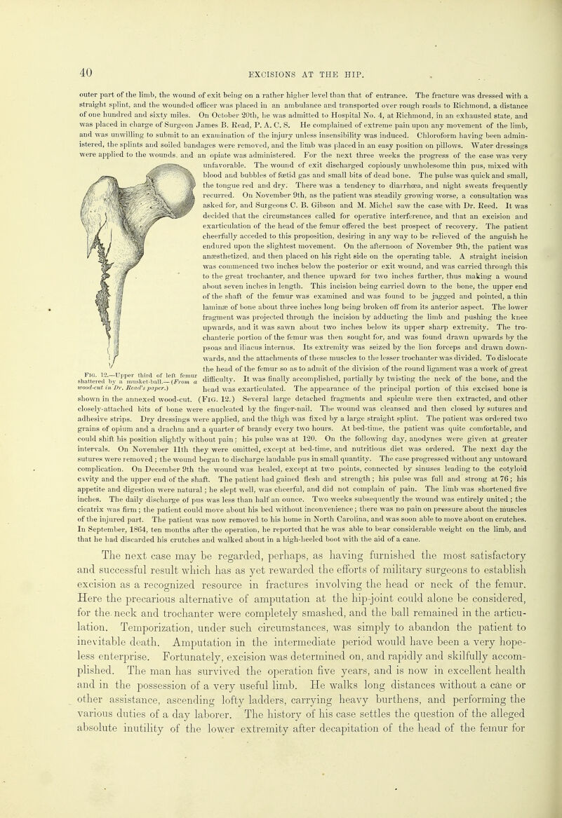 Fig. 12.—Upper third of left femur shattered by a musket-ball.— (From a wood-cut in Dr. Head's paper.) outer part of the limb, the wound of exit being on a rather higher level than that of entrance. The fracture was dressed with a straight splint, and the wounded officer was placed in an ambulance and transported over rough roads to Richmond, a distance of one hundred and sixty miles. On October 20th, he was admitted to Hospital No. 4, at Richmond, in an exhausted state, and was placed in charge of Surgeon James B. Read, P. A. C. S. Tie complained of extreme pain upon any movement of the limb, and was unwilling to submit to an examination of the injury unless insensibility was induced. Chloroform having been admin- istered, the splints and soiled bandages were removed, and the limb was placed in an easy position on pillows. Water dressings were applied to the wounds, and an opiate was administered. For the next three weeks the progress of the case was very unfavorable. The wound of exit discharged copiously unwholesome thin pus, mixed with blood and bubbles of foetid gas and small bits of dead bone. The pulse was quick and small, the tongue red and dry. There was a tendency to diarrhoea, and night sweats frequently recurred. On November 9th, as the patient was steadily growing worse, a consultation was asked for, and Surgeons C. B. Gibson and M. Michel saw the case, with Dr. Reed. It was decided that the circumstances called for operative interference, and that an excision and ex articulation of the head of the femur offered the best prospect of recovery. The patient cheerfully acceded to this proposition, desiring in any way to be relieved of the anguish he endured upon the slightest movement. On the afternoon of November 9th, the patient was anaesthetized, and then placed on his right side on the operating table. A straight incision was commenced two inches below the posterior or exit wound, and was carried through this to the great trochanter, and thence upward for two inches further, thus making a wound about seven inches in length. This incision being carried down to the bone, the upper end of the shaft of the femur was examined and was found to be jagged and pointed, a thin laminae of bone about three inches long being broken off from its anterior aspect. The lower fragment was projected through the incision by adducting the limb and pushing the knee upwards, and it was sawn about two inches below its upper sharp extremity. The tro- chanteric portion of the femur was then sought for, and was found drawn upwards by the psoas and iliacus internus. Its extremity was seized by the lion forceps and drawn down- wards, and the attachments of these muscles to the lesser trochanter was divided. To dislocate the head of the femur so as to admit of the division of the round ligament was a work of great difficulty. It was finally accomplished, partially by twisting the neck of the bone, and the head was exarticulated. The appearance of the principal portion of this excised bone is shown in the annexed wood-cut. (FlG. 12.) Several large detached fragments and spiculse Were then extracted, and other closely-attached bits of bone were enucleated by the finger-nail. The wound was cleansed and then closed by sutures and adhesive strips. Dry dressings were applied, and the thigh was fixed by a large straight splint. The patient was ordered two grains of opium and a drachm and a quarter of brandy every two hours. At bed-time, the patient was quite comfortable, and could shift his position slightly without pain: his pulse was at 120. On the following day,'anodynes were given at greater intervals. On November 11th they were omitted, except at bed-time, and nutritious diet was ordered. The next day the sutures were removed ; the wound began to discharge laudable pus in small quantity. The case progressed without any untoward complication. On December 9th the wound was healed, except at two points, connected by sinuses leading to the cotyloid cavity and the upper end of the shaft. The patient had gained flesh and strength ; his pulse was full and strong at 76; his appetite and digestion were natural; he slept well, was cheerful, and did not complain of pain. The limb was shortened five inches. The daily discbarge of pus was less than half an ounce. Two weeks subsequently the wound was entirely united ; the cicatrix was firm; the patient could move about bis bed without inconvenience; there was no pain on pressure about the muscles of the injured part. The patient was now removed to his home in North Carolina, and was soon able to move about on crutches. In September, 1864, ten months after the operation, he reported that he was able to bear considerable weight on the limb, and that he had discarded his crutches and walked about in a high-heeled boot with the aid of a cane. The next case may be regarded, perhaps, as having furnished the most satisfactory and successful result which has as yet rewarded the efforts of military surgeons to establish excision as a recognized resource in fractures involving the head or neck of the femur. Here the precarious alternative of amputation at the hip-joint could alone be considered, for the. neck and trochanter were completely smashed, and the ball remained in the articu- lation. Temporization, under such circumstances, was simply to abandon the patient to inevitable death. Amputation in the intermediate period would have been a very hope- less enterprise. Fortunately, excision was determined on, and rapidly and skilfully accom- plished. The man has survived the operation five years, and is now in excellent health and in the possession of a very useful limb. He walks long distances without a cane or other assistance, ascending lofty ladders, carrying heavy burthens, and performing the various duties of a day laborer. The history of his case settles the question of the alleged absolute inutility of the lower extremity after decapitation of the head of the femur for