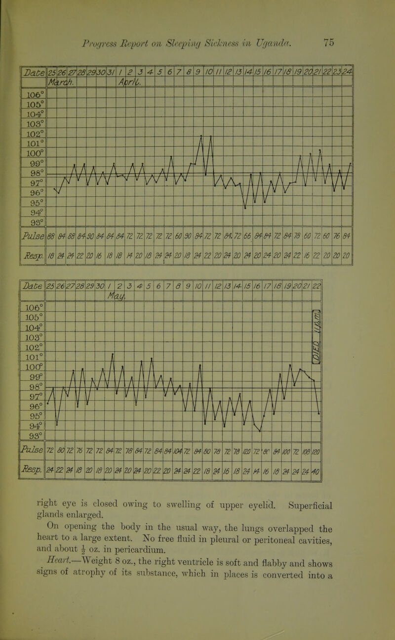 right eye is closed owing to swelling of upper eyelicl. Superficial glands enlarged. On opening the body in the usual way, the lungs overlapped the heart to a large extent. No free fluid in pleural or peritoneal cavities, and about ^ oz. in pericardium. ^ i^m?!—Weight 8 oz., the right ventricle is soft and flabby and shows signs of atrophy of its substance, which in places is converted into a