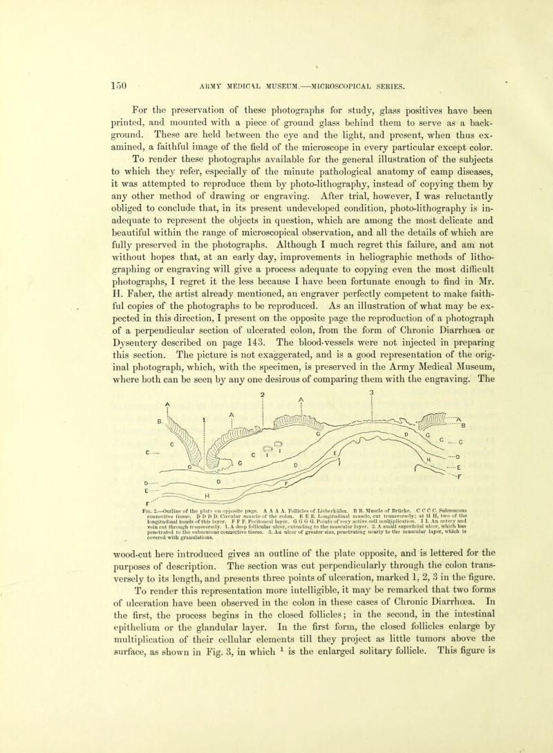 For the preservation of these photographs for study, glass positives have been printed, and mounted with a piece of ground glass behind them to serve as a back- ground. These are held between the eye and the light, and present, when thus ex- amined, a faithful image of the field of the microscope in every particular except color. To render these photographs available for the general illustration of the subjects to which they refer, especially of the minute pathological anatomy of camp diseases, it was attempted to reproduce them by photo-lithography, instead of copying them by any other method of drawing or engraving. After trial, however, I was reluctantly obliged to conclude that, in its present undeveloped condition, photo-lithography is in- adequate to represent the objects in question, which are among the most delicate and beautiful within the range of microscopical observation, and all the details of which are fully preserved in the photographs. Although I much regret this failure, and am not without hopes that, at an early day, improvements in heliographic methods of litho- graphing or engraving will give a process adequate to copying even the most difficult photographs, I regret it the less because I have been fortunate enough to find in Mr. H. Faber, the artist already mentioned, an engraver perfectly competent to make faith- ful copies of the photographs to be reproduced. As an illustration of what may be ex- pected in this direction, I present on the opposite page the reproduction of a photograph of a perpendicular section of ulcerated colon, from the form of Chronic Diarrhoea or Dysentery described on page 143. The blood-vessels were not injected in preparing this section. The picture is not exaggerated, and is a good representation of the orig- inal photograph, which, with the specimen, is preserved in the Army Medical Museum, where both can be seen by any one desirous of comparing them with the engraving. The Fia. 2.—Outline of the plnte on opposite pnge. A A A A. Pellicles of Lieljorkiiim. B Ji. Muscle of Brilcke. C C C C. Submucons connective tissue. D 1) D D. Circular muscle of the colon. K E E. L iri;;itniliiial muscle, cut transversely; at II II, two of llio longitudinal bands of this layer. F F F. Peritoneal layer. G G G G. Poijits of very active cell multiplication. I I. An artery and vein cut through transversely. 1. A deep follicular ulcer, extending to the muscular layer. 2. A small superficial ulcer, which has penetrated to the submucous conuectivo tissue. 3. An ulcer of greater size, penetrating nearly to the muscular layer, which is covered with granulations. wood-cut here introduced gives an outline of the plate opposite, and is lettered for the purposes of description. The section was cut perpendicularly through the colon trans- versely to its length, and presents three points of ulceration, marked 1, 2, 3 in the figure. To render this representation more intelligible, it may be remarked that two forms of ulceration have been observed in the colon in these cases of Chronic Diarrhoea. In the first, the process begins in the closed follicles; in the second, in the intestinal epithelium or the glandular layer. In the first form, the closed follicles enlarge by multiplication of their cellular elements till they project as little tumors above the surface, as shown in Fig. 3, in which ^ is the enlarged solitary follicle. This figure is