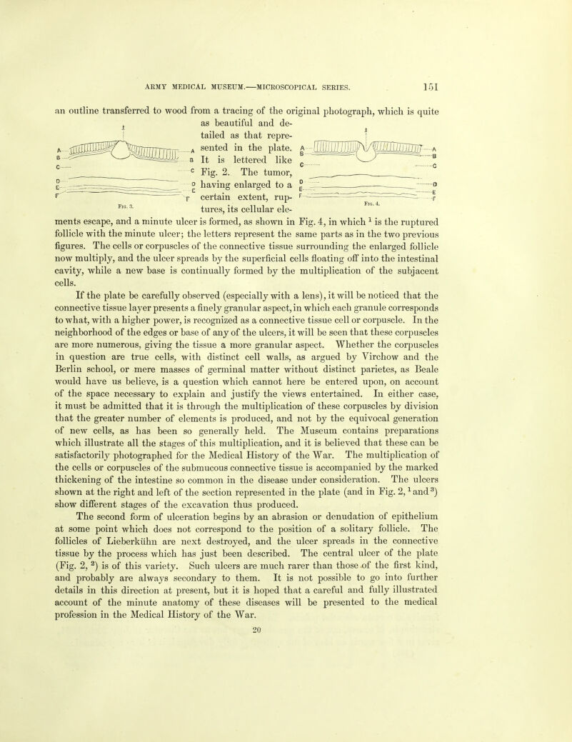an outline transferred to wood from a tracing of the original photograph, which is quite , as beautiful and de- ■ . i tailed as that repre- ! --^^™^^^^>Mt^ A rented in the plate. a---^MMIN/^^^------a B— ■ - . I ^ ,g It IS lettered like ^\ = Fig. 2. The tumor, jir:i:r:z3r:^=:=:—° having enlarged to a ^' ~~ T certain extent, rup- ^ - i^rzrzrrrr -dr- ^ Fig 4 tures, its cellular ele- ments escape, and a minute ulcer is formed, as shown in Fig. 4, in which ^ is the ruptured follicle with the minute ulcer; the letters represent the same parts as in the two previous figures. The cells or corpuscles of the connective tissue surrounding the enlarged follicle now multiply, and the ulcer spreads by the superficial cells floating ofi into the intestinal cavity, while a new base is continually formed by the multiplication of the subjacent cells. If the plate be carefully observed (especially with a lens), it will be noticed that the connective tissue layer presents a finely granular aspect, in which each granule corresponds to what, with a higher power, is recognized as a connective tissue cell or corpuscle. In the neighborhood of the edges or base of any of the ulcers, it will be seen that these corpuscles are more numerous, giving the tissue a more granular aspect. Whether the corpuscles in question are true cells, with distinct cell walls, as argued by Virchow and the Berlin school, or mere masses of germinal matter without distinct parietes, as Beale would have us believe, is a question which cannot here be entered upon, on account of the space necessary to explain and justify the views entertained. In either case, it must be admitted that it is through the multiplication of these corpuscles by division that the greater number of elements is produced, and not by the equivocal generation of new cells, as has been so generally held. The Museum contains preparations which illustrate all the stages of this multiplication, and it is believed that these can be satisfactorily photographed for the Medical History of the War. The multiplication of the cells or corpuscles of the submucous connective tissue is accompanied by the marked thickening of the intestine so common in the disease under consideration. The ulcers shown at the right and left of the section represented in the plate (and in Fig. 2, ^ and ^) show difierent stages of the excavation thus produced. The second form of ulceration begins by an abrasion or denudation of epithelium at some point which does not correspond to the position of a solitary follicle. The follicles of Lieberkiihn are next destroyed, and the ulcer spreads in the connective tissue by the process which has just been described. The central ulcer of the plate (Fig. 2, ^) is of this variety. Such ulcers are much rarer than those of the first kind, and probably are always secondary to them. It is not possible to go into further details in this direction at present, but it is hoped that a careful and fully illustrated account of the minute anatomy of these diseases will be presented to the medical profession in the Medical History of the War. 20