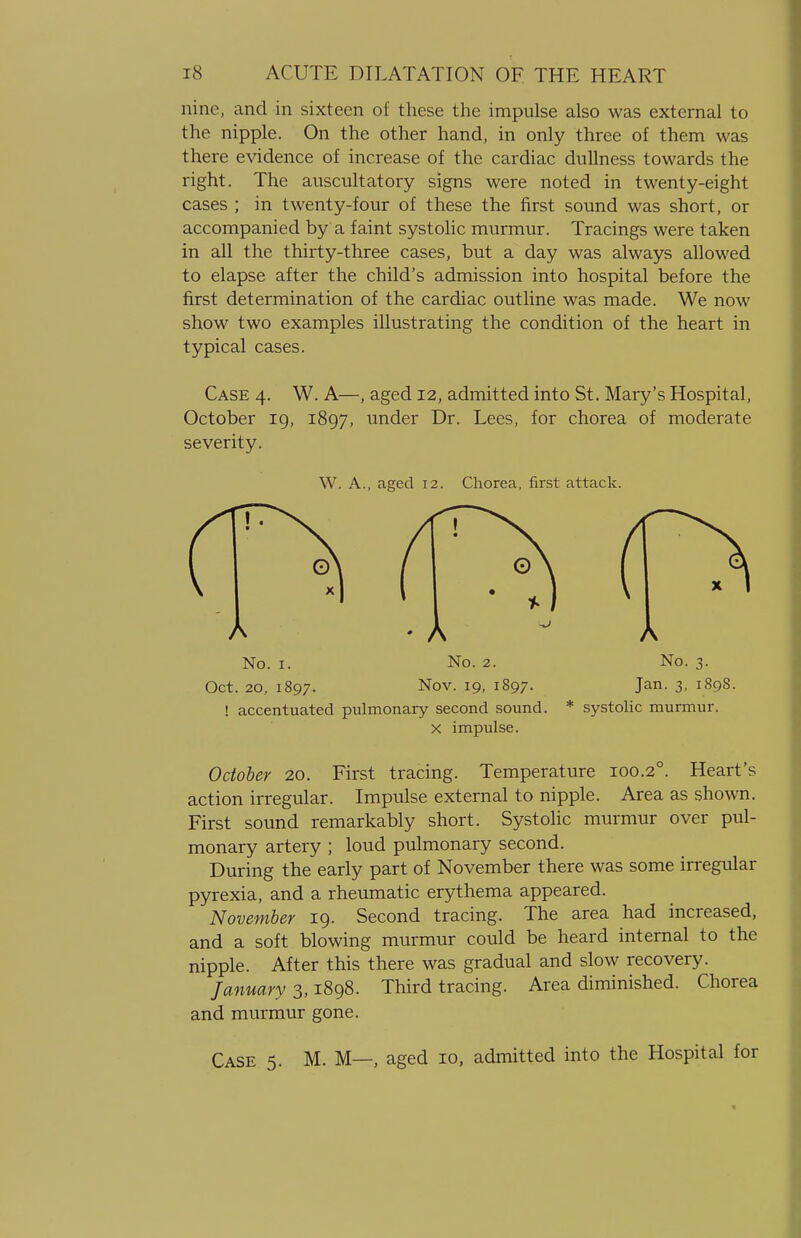 nine, and in sixteen of these the impulse also was external to the nipple. On the other hand, in only three of them was there evidence of increase of the cardiac dullness towards the right. The auscultatory signs were noted in twenty-eight cases ; in twenty-four of these the first sound was short, or accompanied by a faint systolic murmur. Tracings were taken in all the thirty-three cases, but a day was always allowed to elapse after the child's admission into hospital before the first determination of the cardiac outline was made. We now show two examples illustrating the condition of the heart in typical cases. Case 4. W. A—, aged 12, admitted into St. Mary's Hospital, October 19, 1897, under Dr. Lees, for chorea of moderate severity. W. A., aged 12. Chorea, first attack. • A No. 1. No. 2. Oct. 20, 1897. Nov. 19, 1897. ! accentuated pulmonary second sound. X impulse. A No. 3. Jan. 3, 189S. * systolic murmur. October 20. First tracing. Temperature 100.20. Heart's action irregular. Impulse external to nipple. Area as shown. First sound remarkably short. Systolic murmur over pul- monary artery ; loud pulmonary second. During the early part of November there was some irregular pyrexia, and a rheumatic erythema appeared. November 19. Second tracing. The area had increased, and a soft blowing murmur could be heard internal to the nipple. After this there was gradual and slow recovery. January 3,1898. Third tracing. Area diminished. Chorea and murmur gone. Case 5. M. M—, aged 10, admitted into the Hospital for