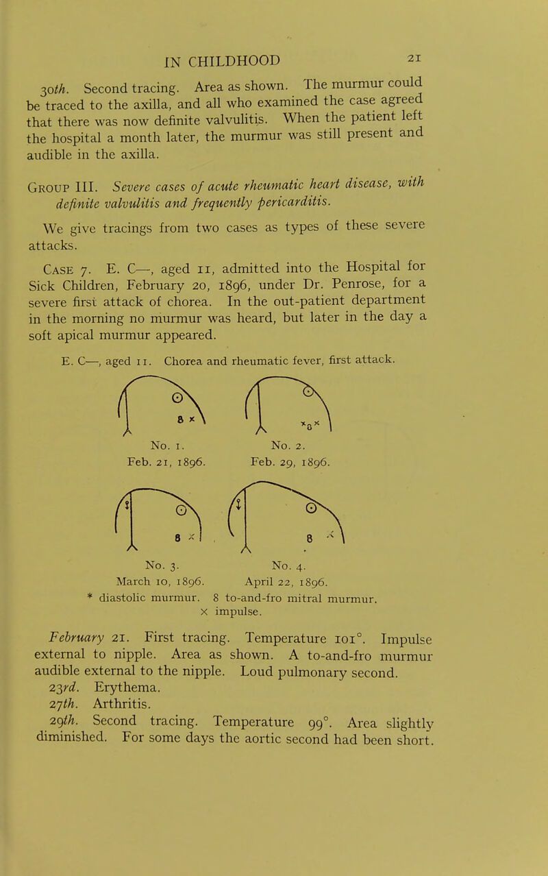 30/A. Second tracing. Area as shown. The murmur could be traced to the axilla, and all who examined the case agreed that there was now definite valvulitis. When the patient left the hospital a month later, the murmur was still present and audible in the axilla. Group III. Severe cases of acute rheumatic heart disease, with definite valvulitis and frequently pericarditis. We give tracings from two cases as types of these severe attacks. Case 7. E. C—, aged 11, admitted into the Hospital for Sick Children, February 20, 1896, under Dr. Penrose, for a severe first attack of chorea. In the out-patient department in the morning no murmur was heard, but later in the day a soft apical murmur appeared. E. C—, aged 11. Chorea and rheumatic fever, first attack. No. 1. Feb. 2i, 1896. A No. 3. March 10, 1896. * diastolic murmur. A No. 4. April 22, 1896. 8 to-and-fro mitral murmur. X impulse. February 21. First tracing. Temperature 1010. Impulse external to nipple. Area as shown. A to-and-fro murmur audible external to the nipple. Loud pulmonary second. 2yd. Erythema. 27^. Arthritis. 29th. Second tracing. Temperature 990. Area slightly diminished. For some days the aortic second had been short.