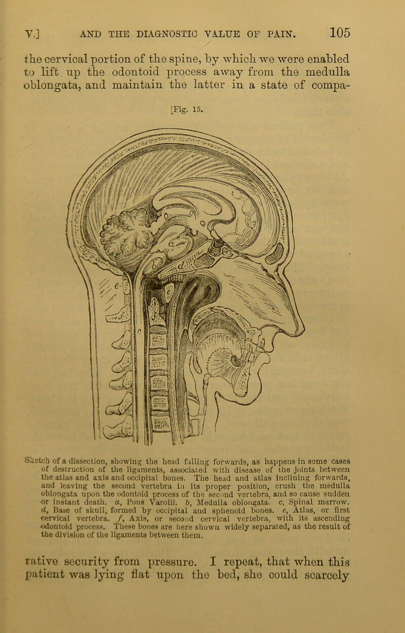 the cervical portion of the spine, by which we were enabled to lift up the odontoid process away from the medulla oblongata, and maintain the latter in a state of compa- !Fig. 15. Sketch of a dissection, showing the head falling forwards, as happens in some cases of destruction of the ligaments, associated with disease of the joints between the atlas and axis and occipital bones. The head and atlas Inclining forwards, and leaving the second vertebra in its proper position, crush the medulla oblongata upon the odontoid process of the second vertebra, and so cause sudden or instant death, a, Pons Varolii. b, Medulla oblongata, c, Spinal marrow. d, Base of skull, formed by occipital and sphenoid bones, e, Atlas, or first cervical vertebra. /, Axi3, or second cervical vertebra, with its ascending odontoid process. These bone3 are here shown widely separated, as the result of the division of the ligaments between them. rative security from pressure. I repeat, that whon this patient was lying flat upon tho bod, she could scarcoly