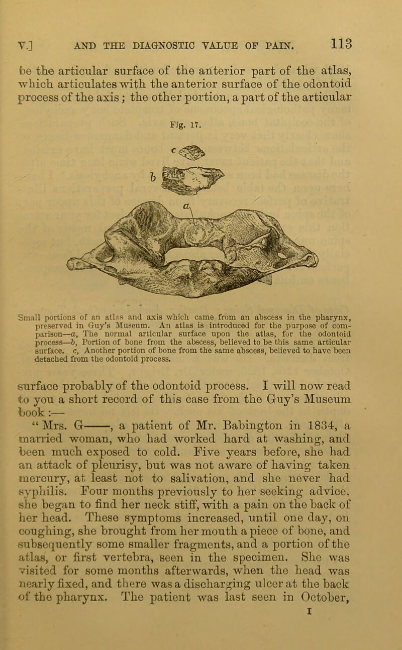 be the articular surface of the anterior part of the atlas, which articulates with the anterior surface of the odontoid process of the axis; the other portion, a part of the articular Fig. IV. Small portions of an atlas and axis which came from an abscess in the pharynx, preserved in Guy’s Museum. An atlas is introduced for the purpose of com- parison—a, The normal articular surface upon the atlas, for the odontoid process—b, Portion of bone from the abscess, believed to be this same articular surface, c. Another portion of bone from the same abscess, believed to have been detached from the odontoid process. surface probably of the odontoid process. I will now read to you a short record of this case from the Guy’s Museum book:— “ Mrs. G , a patient of Mr. Babington in 1834, a married woman, who had worked hard at washing, and been much exposed to cold. Five years before, she had an attack of pleurisy, but was not aware of having taken mercury, at least not to salivation, and she never had syphilis. Four months previously to her seeking advice, she began to find her neck stiff, with a pain on the back of her head. These symptoms increased, until one day, on coughing, she brought from her mouth a piece of bone, and subsequently some smaller fragments, and a portion of the atlas, or first vertebra, seen in the specimen. She was visited for some months afterwards, when the head was nearly fixed, and there was a discharging ulcer at the back of the pharynx. The patient was last seen in October,