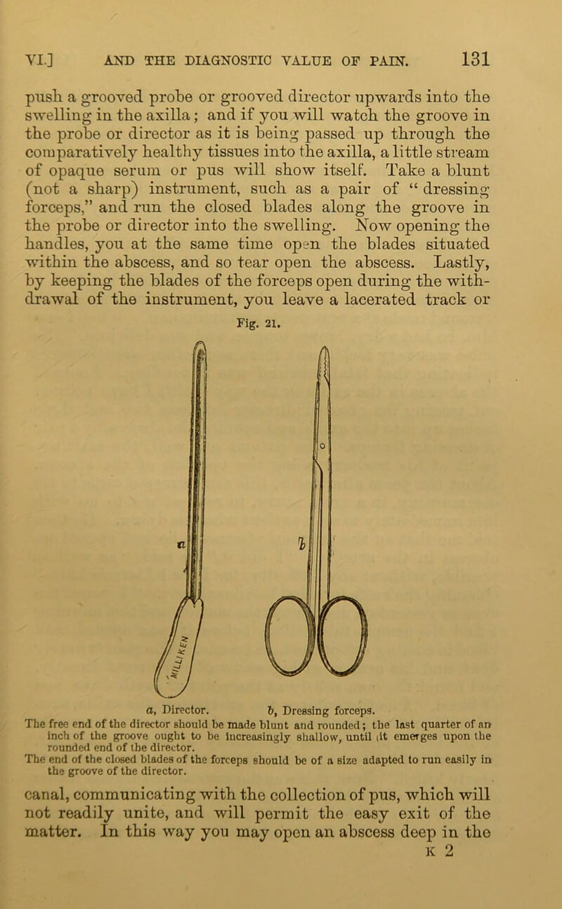 push a grooved probe or grooved director upwards into the swelling in the axilla; and if you will watch the groove in the probe or director as it is being passed up through the comparatively healthy tissues into the axilla, a little stream of opaque serum or pus will show itself. Take a blunt (not a sharp) instrument, such as a pair of “ dressing- forceps,” and run the closed blades along the groove in the probe or director into the swelling. Now opening the handles, you at the same time opm the blades situated within the abscess, and so tear open the abscess. Lastly, by keeping the blades of the forceps open during the with- drawal of the instrument, you leave a lacerated track or Fig. 21. a, Director. 6, Dressing forceps. The free end of the director should be made blunt and rounded; the last quarter of an inch of the groove ought to be increasingly shallow, until lit emerges upon the rounded end of the director. The end of the closed blades of the forceps should be of a size adapted to run easily in the groove of the director. canal, communicating with the collection of pus, which will not readily unite, and will permit the easy exit of the matter. In this way you may open an abscess deep in the