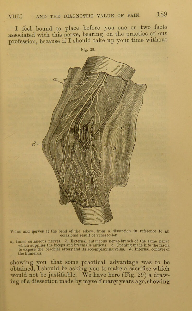 I feel bound to place before you one or two facts associated with this nerve, bearing on the practice of our profession, because if I should take up your time without Fig. 29. Veins and nerves at the bend of the elbow, from a dissection in reference to an occasional result of venesection. a, Inner cutaneous nerves, b, External cutaneous nerve-branch of the same nerve which supplies the biceps and brachialis anticus. c, Opening made into the fascia to expose the brachial artery and its accompanying veins, d, Internal condyle of the humerus. showing you that some practical advantage was to be obtained, I should be asking you to make a sacrifice which would not be justifiable. We have here (Fig. 29) a draw- ing of a dissection made by myself many years ago, showing