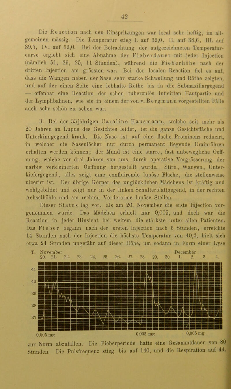 Die Reaction nach den Einspritzungen war local sehr heftig, im all- gemeinen raassig. Die Temperatur stieg I. auf 39,0, II. auf 38,6, III. auf 39,7, IV. auf 39,0. Bei der Betrachtung der aufgezeiclmeten Temperatur- curve ergiebt sich eino Abnahmo der Fieberdauer rait jeder Injection (namlich 51, 29, 25, 11 Stunden), wahrend die Fieberhohe nach der dritten Injection am grossten war. Bei der localen Reaction fiel es auf, dass die Wangen neben der Nase sebr starke Schwellung und Ilothe zeigten, und auf der einen Seite eine lebhafte Rothe bis in die Submaxillargegend — offenbar eine Reaction der schon tuberculos inficirten Hautpartie und der Lymphbahnen, wie sie in cinem der von v. Bergmann vorgestellten Fiille auch sehr schiin zu sehen war. 3. Bei der 33jahrigen Caroline Hausmann, welche seit mehr als 20 Jahren an Lupus des Gesichtes leidet, ist die ganze Gesichtsflache und Unterkinngegend krank. Die Nase ist auf eine flache Protninenz reducirt, in welcher die Nasenlocher nur durch permanent liegende Drainrohren erhalten werden konnen; der Mund ist eine starre, fast unbewegliche Oeff- nung, welche vor drei Jahren von uns durch operative Vergrosserung der narbig verkleinerten Oeffnung hergestellt wurde. Stirn, Wangeu, Unter- kiefergegend, alles zeigt eine confluirende lupose Flache, die stellenweise ulcerirt ist. Der iibrige Korper des ungliicklichen Madchens ist kraftig und wohlgebildet und zeigt nur in der linken Schulterblattgegend, in der rechten Achselhohle und am rechten Vorderarme lupose Stellen. Dieser Status lag vor, als am 20. November die erste Injection vor- genommen wurde. Das Madchen erhielt nur 0,005, und doch war die Reaction in jeder Hinsicht bei weitem die starkste unter alien Patienten. Das Fieber begann nach der ersten Injection nach 6 Stunden, erreichte 14 Stunden nach der Injection die hochste Temperatur von 40,2, hielt sich etwa 24 Stunden ungefahr auf dieser Hohe, urn sodann in Form einer Lyse . T. November December 20. 21. 22. 23. 24. 25. 26. 27. 28. 29. 30. 1. 2. 3. 4. 4i333333ES33333S333333S3333333ES IMmimiilillllllillllli Iliiiiiiiiilliii :iiiiiiiiiiiiiiii 37 0,005 mg0,005 mg 0,005 mg zur Norm abzufallen. Die Fieberperiode hatte eine Gesammtdauer von 80 Stunden. Die Pulsfrequenz stieg bis auf 140, und die Respiration auf 44. 33E3Skbb3SSSsbb3SEbb3BBSS3Es! isa sis 19 lilli 0,005 mg 0,005 mg 0,005 mg